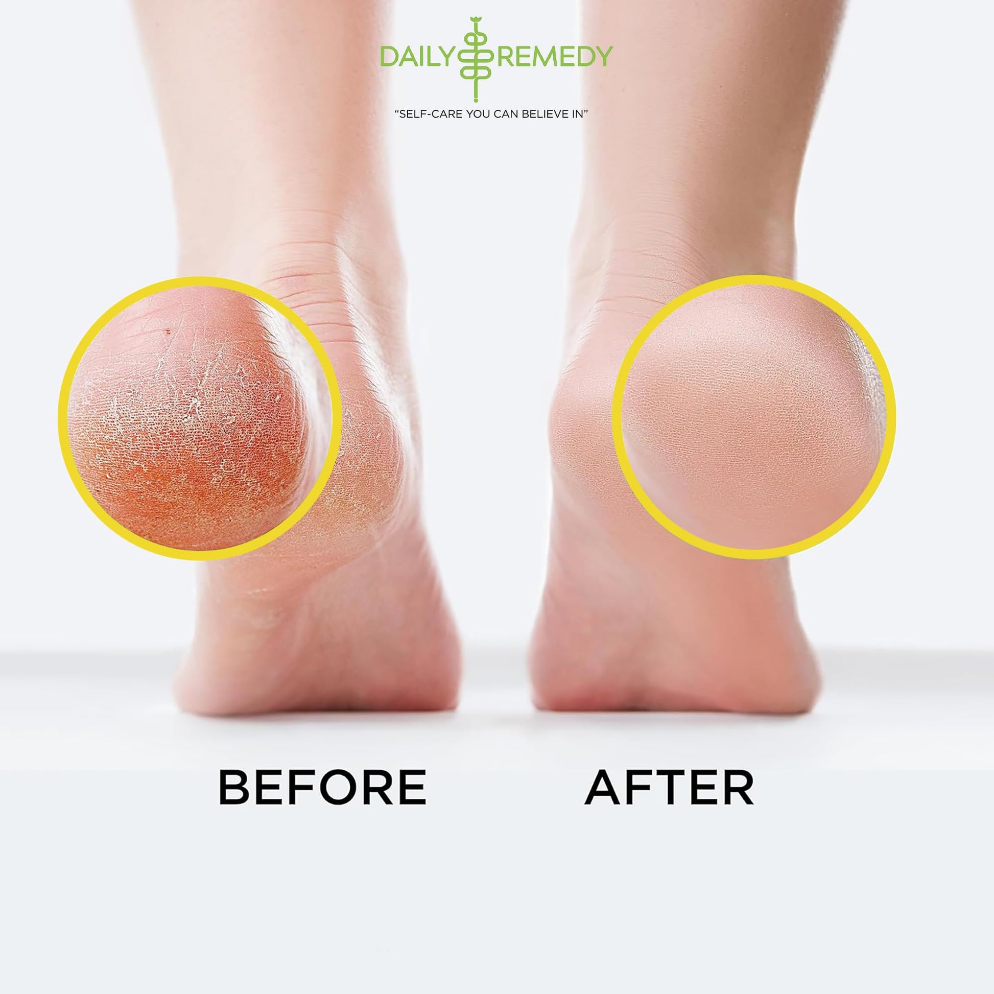 Citrus Detox Foot Soak with Epsom Salt - for Foot Callus, Immune Boost, Damaged Toenail DAILY REMEDYUS supplements
