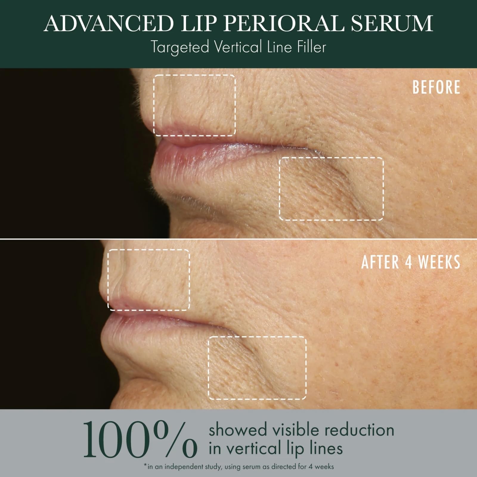 RéVive Advanced Perioral Lip Serum - Anti Aging Perioral Lip Treatment to Reduce Lip Area Lines & Wrinkles -Helps Restore Lip Contour & Visible Fullness(0.5 fl oz) RéViveAu supplements