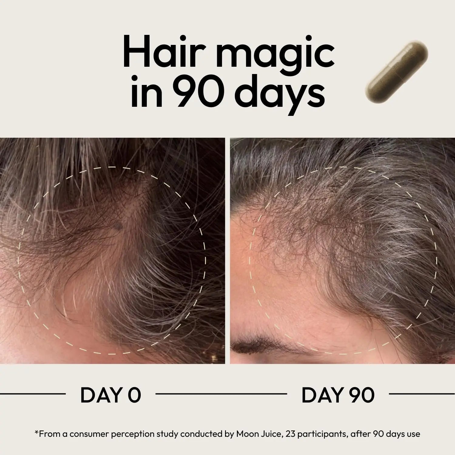 Moon Juice SuperHair Hair Growth Vitamins for Women & Men with Biotin & Saw Palmetto - Clinical Strength Multivitamin Hair Supplement Moon JuiceAu supplements