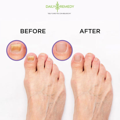 Calming Lavender Foot Soak with Epsom Salt, Made in USA, Foot Soak Soothes Sore Tired DAILY REMEDYUS supplements