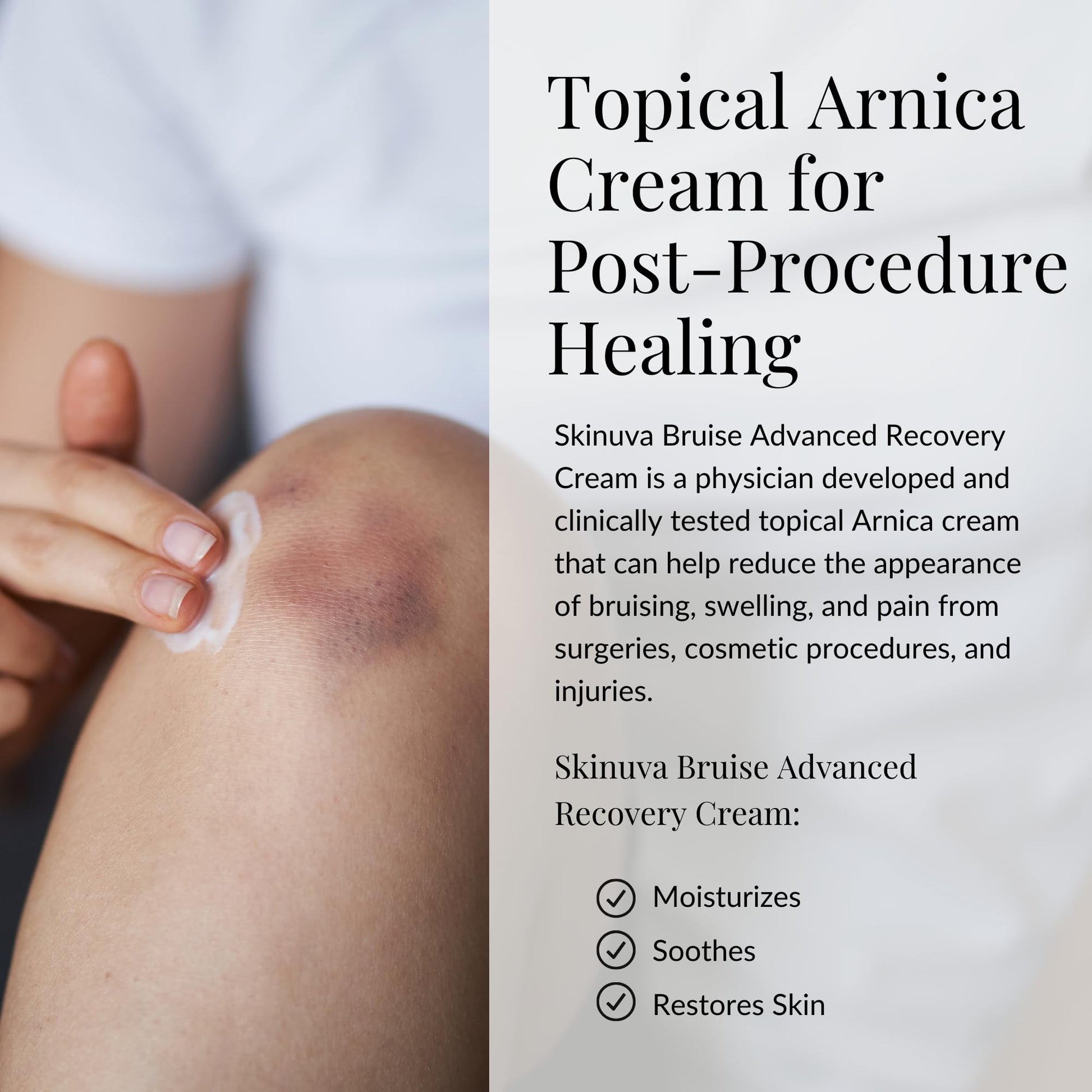 Skinuva® Bruise Advanced Recovery Cream - Topical Bruise Cream Formulated with Growth Factors, Arnica & Vitamin K (1 oz) SkinuvaAu supplements