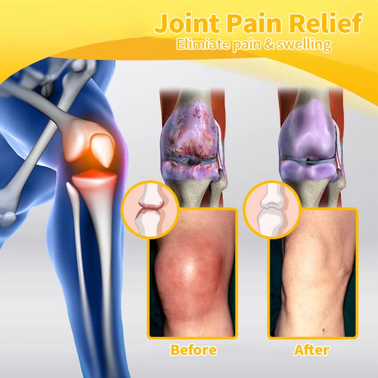 Luhaka Botulinum Toxin & Bee Venom Pain-Relief Bone Healing Cream,Bee Venom Cream,Effectively improve joint mobility (1PC) LuhakaAu supplements