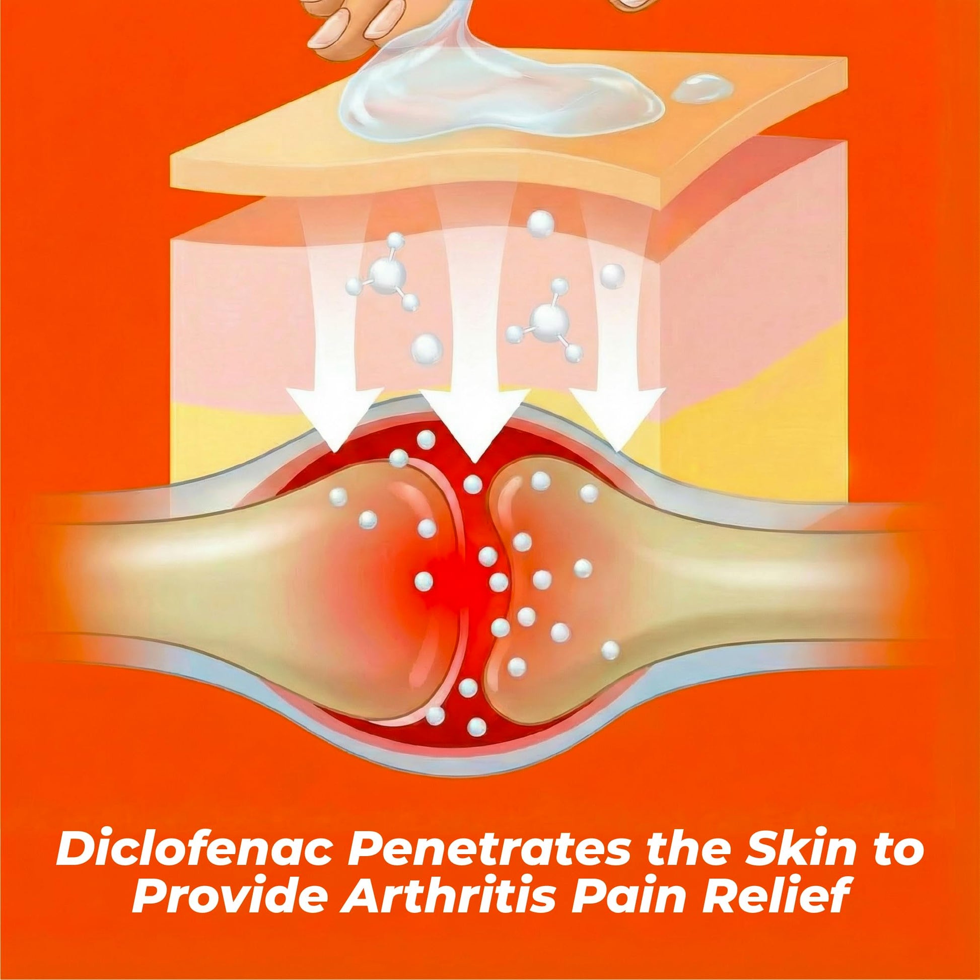 Aspercreme Arthritis Pain Relief Gel for Arthritis & Joint Pain, Non-steroidal Anti-inflammatory Topical Gel with Max-Strength Diclofenac Sodium, 50 g AspercremeAu supplements