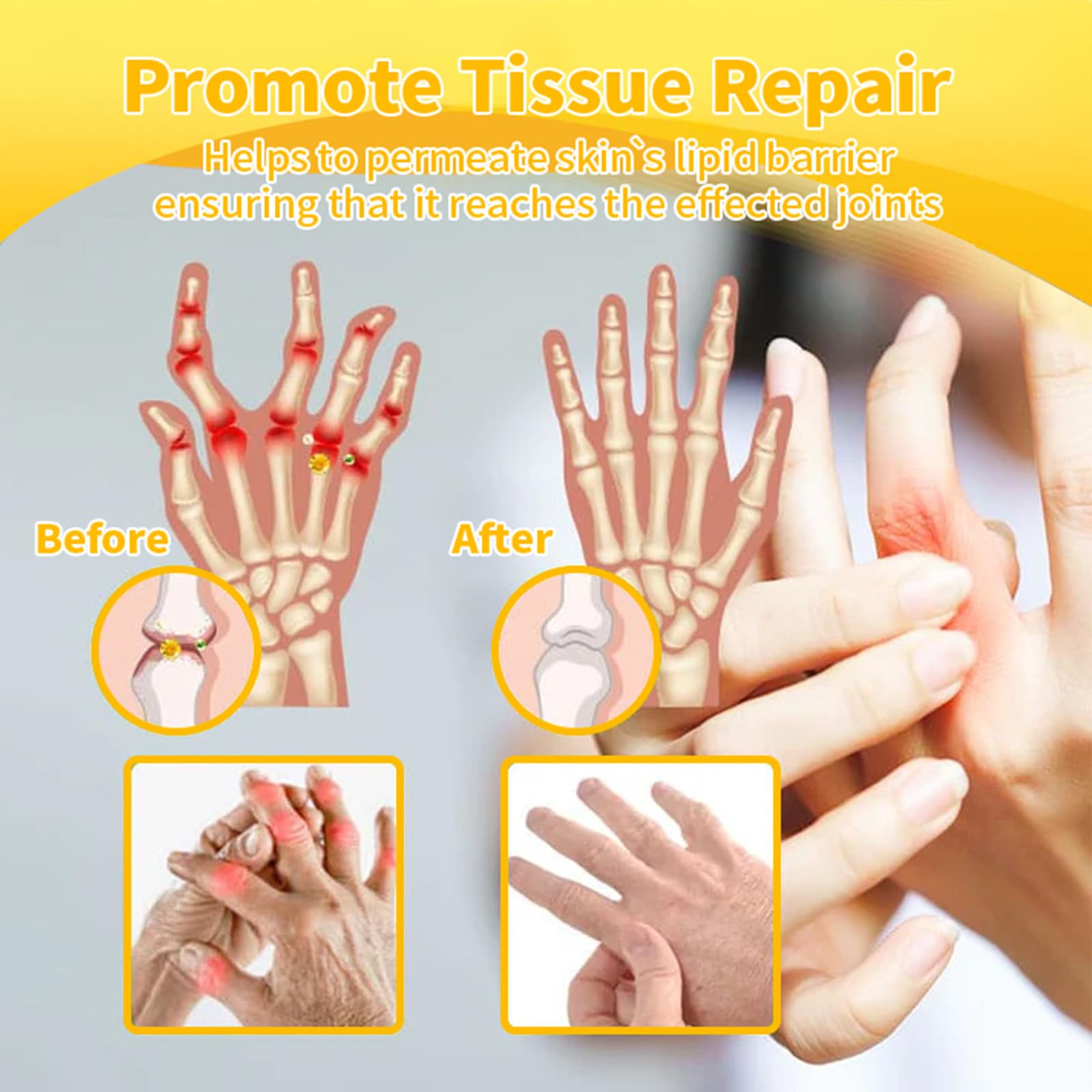 Luhaka Botulinum Toxin & Bee Venom Pain-Relief Bone Healing Cream,Bee Venom Cream,Effectively improve joint mobility (1PC) LuhakaAu supplements