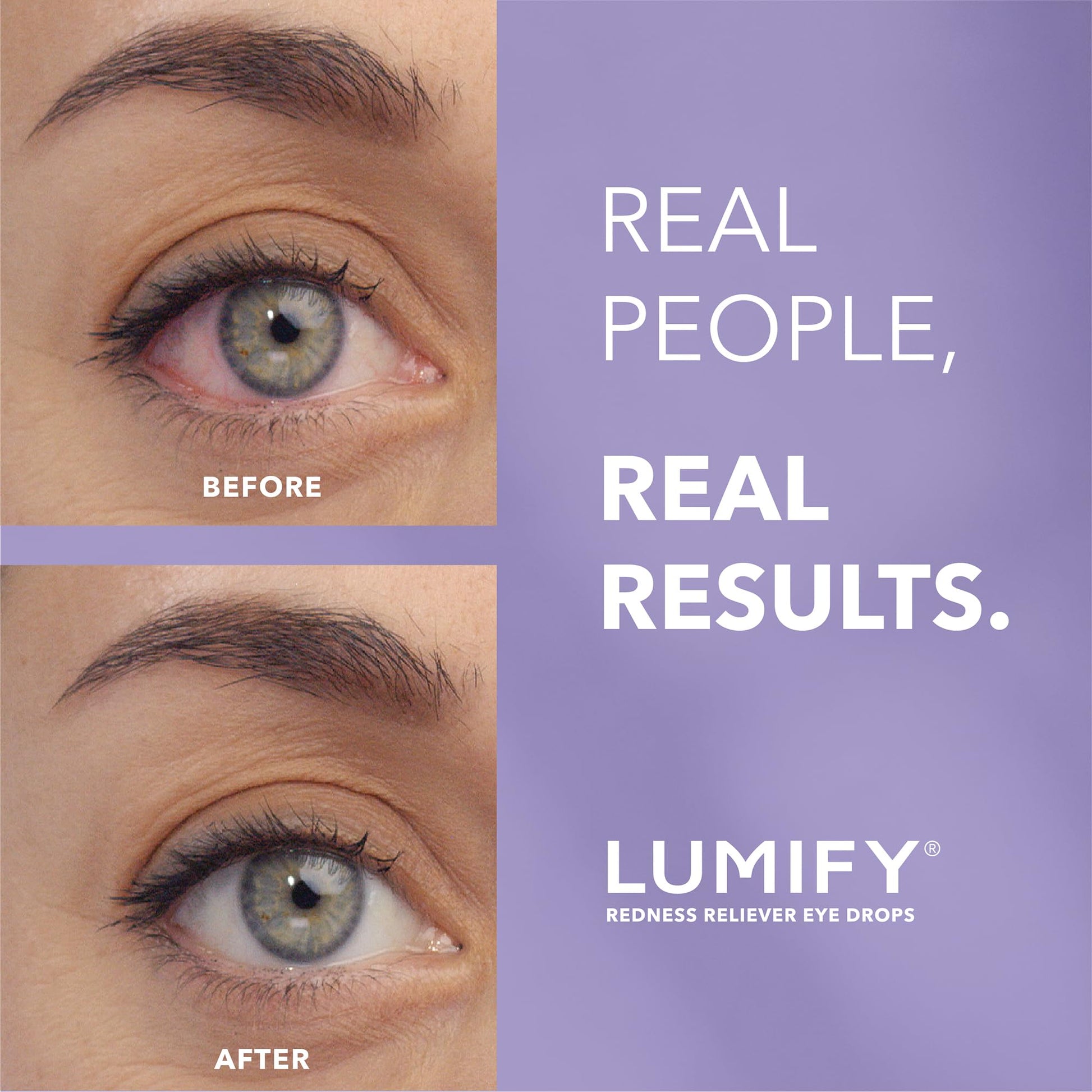 LUMIFY Eye Drops for Red Eyes, Redness Reliever for Brighter Looking Eyes, Works in 1 Minute & Lasts Up to 8 Hours, Eye Drops, 0.17 Fl Oz (5 mL) LUMIFYAu supplements