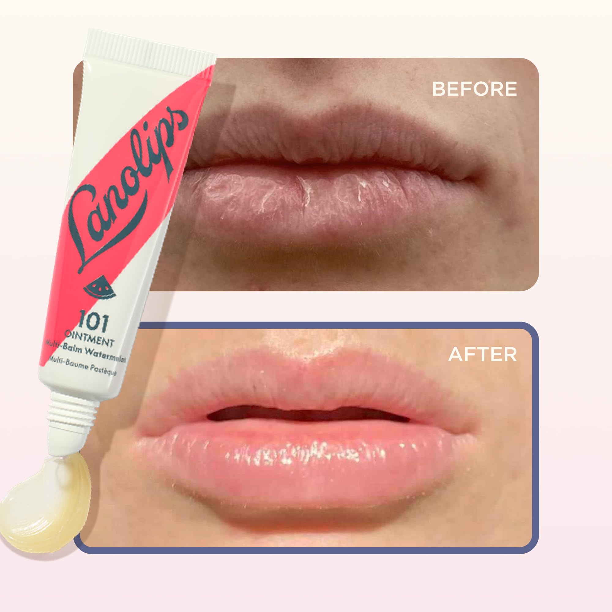 Lanolin 101 Multipurpose Ointment - Lanolin Lip Balm & Healing Ointment for Skin Barrier Repair - Moisturizer for Dry Lips, Cuticles & Elbows - No Petroleum Formula - Watermelon (0.35 oz) LanolipsAu supplements