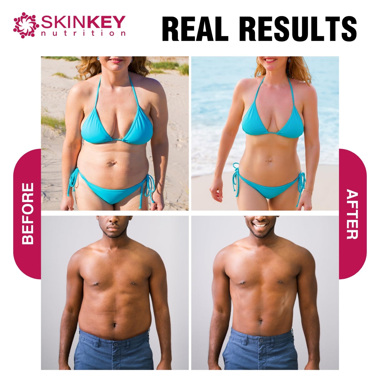 Weight Loss Pills for Women - Fat Burner Diet That Work Fast & Men Made in USA SKINKEY NutritionUS supplements