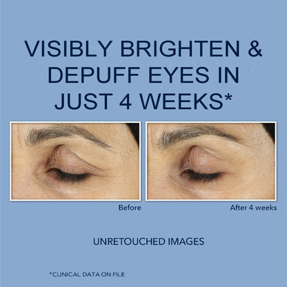 RoC Retinol Correxion Eye Cream Mini for Dark Circles & Puffiness, Daily Wrinkle RoCUS supplements