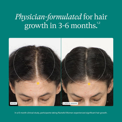 Nutrafol Women's Hair Growth Supplements, Ages 18-44, Clinically Proven for Visibly Thicker and Stronger Hair, Dermatologist Recommended - 1 Month Supply NutrafolUS supplements