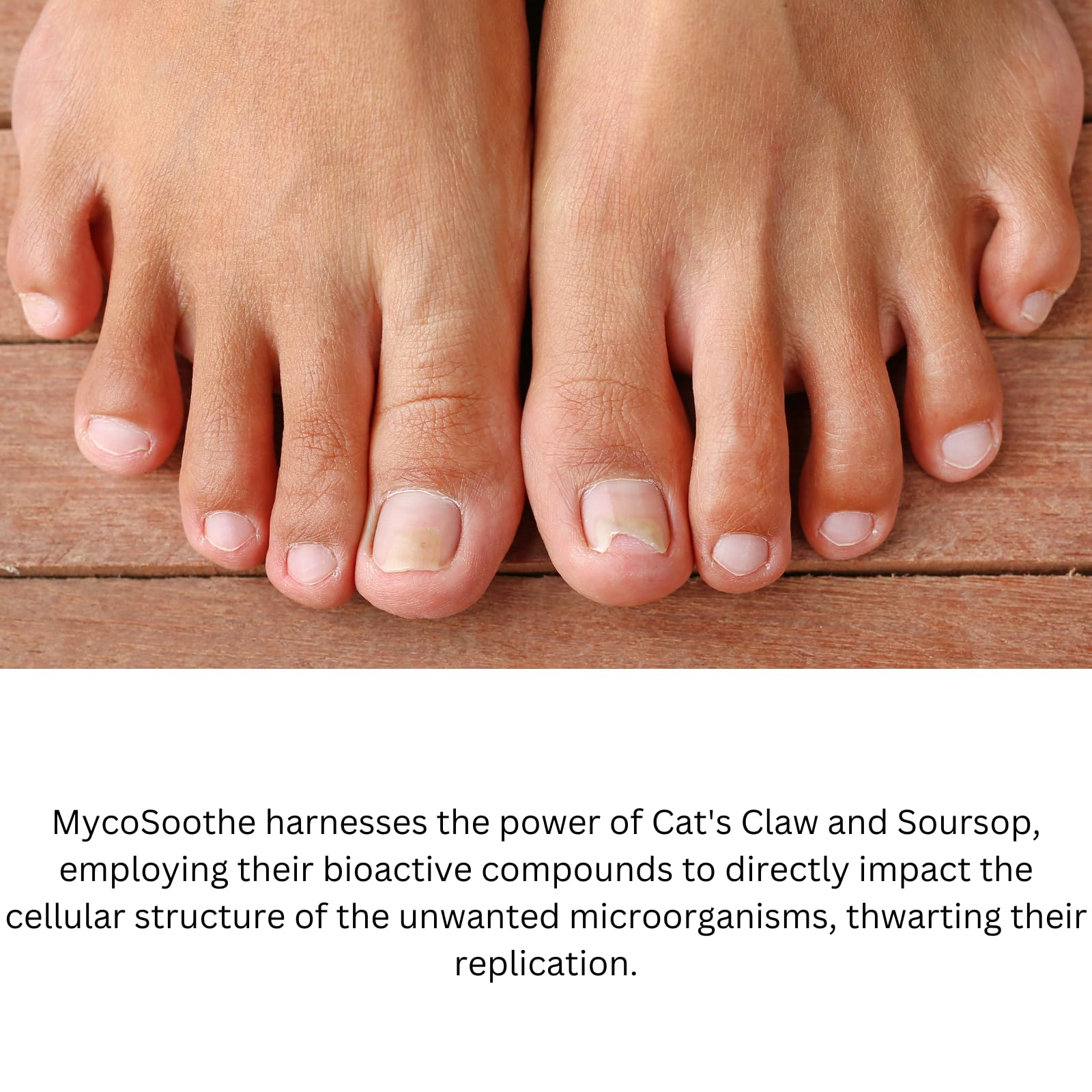 Phytage Labs MycoSoothe Advanced Hair, Skin, Nail & Immunity Support Formula - 60 Capsules Phytage LabsAu supplements