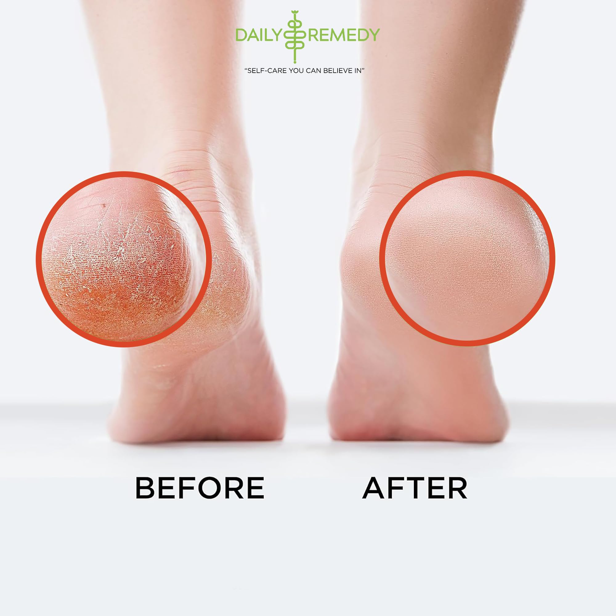 Muscle Relief Foot Soak with Epsom Salt, Made in USA, Soothe Foot Aches, Muscle Pain DAILY REMEDYUS supplements