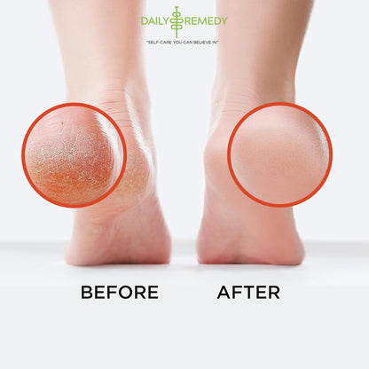 Muscle Relief Foot Soak with Epsom Salt, Made in USA, Soothe Foot Aches, Muscle Pain DAILY REMEDYUS supplements