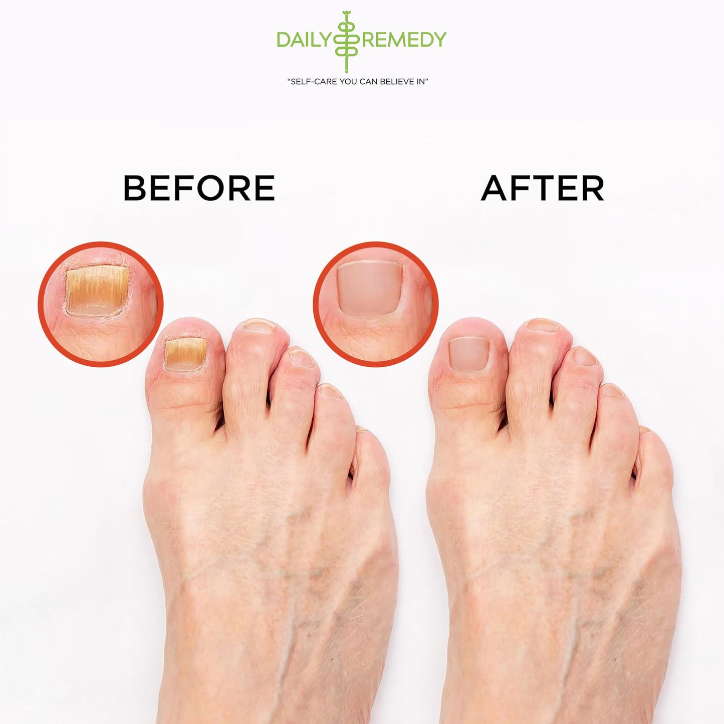 Muscle Relief Foot Soak with Epsom Salt, Made in USA, Soothe Foot Aches, Muscle Pain DAILY REMEDYUS supplements