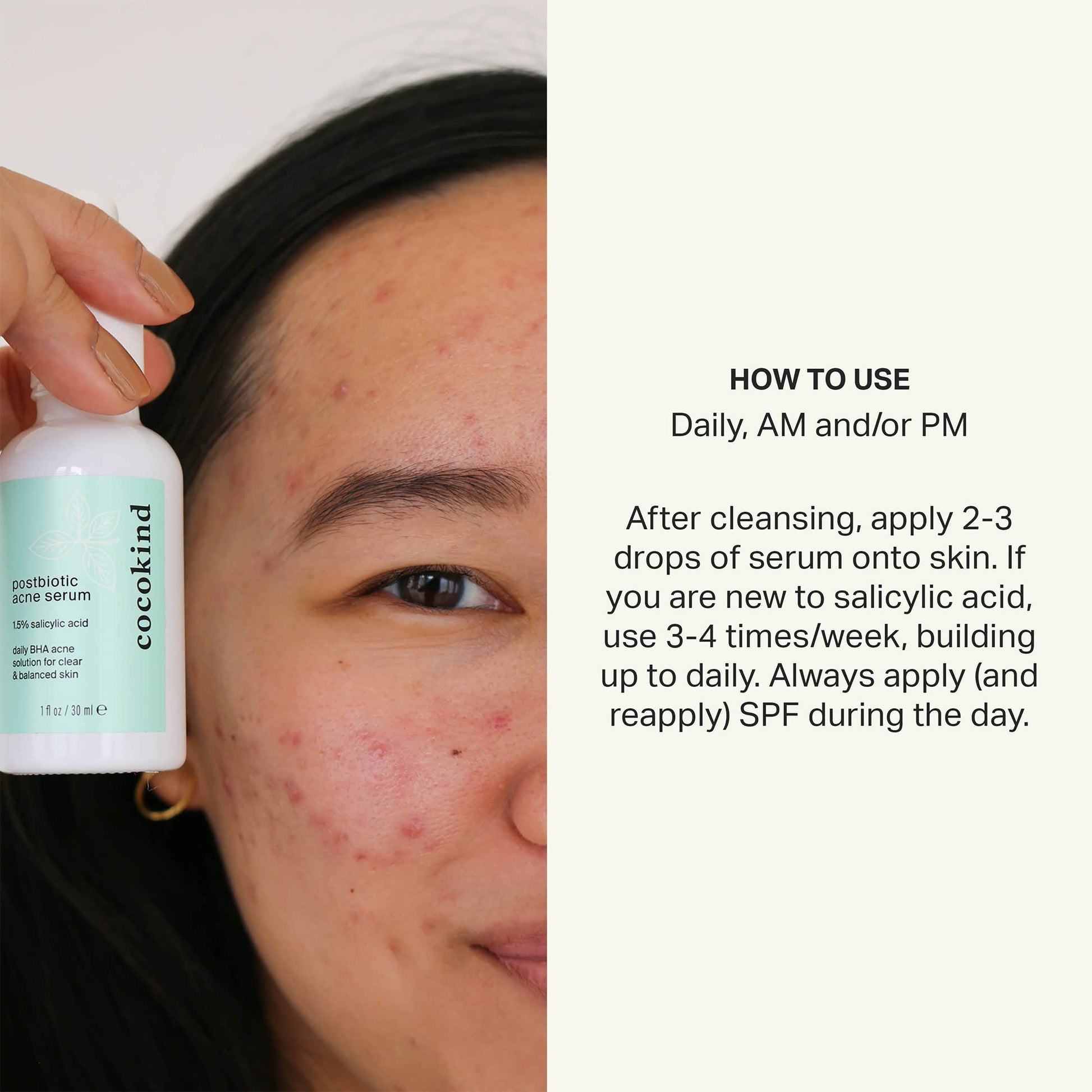 Cocokind Postbiotic Acne Serum, Salicylic Acid Serum and BHA Liquid Exfoliant - Exfoliating, Brightening and Hydrating Serum CocokindAu supplements