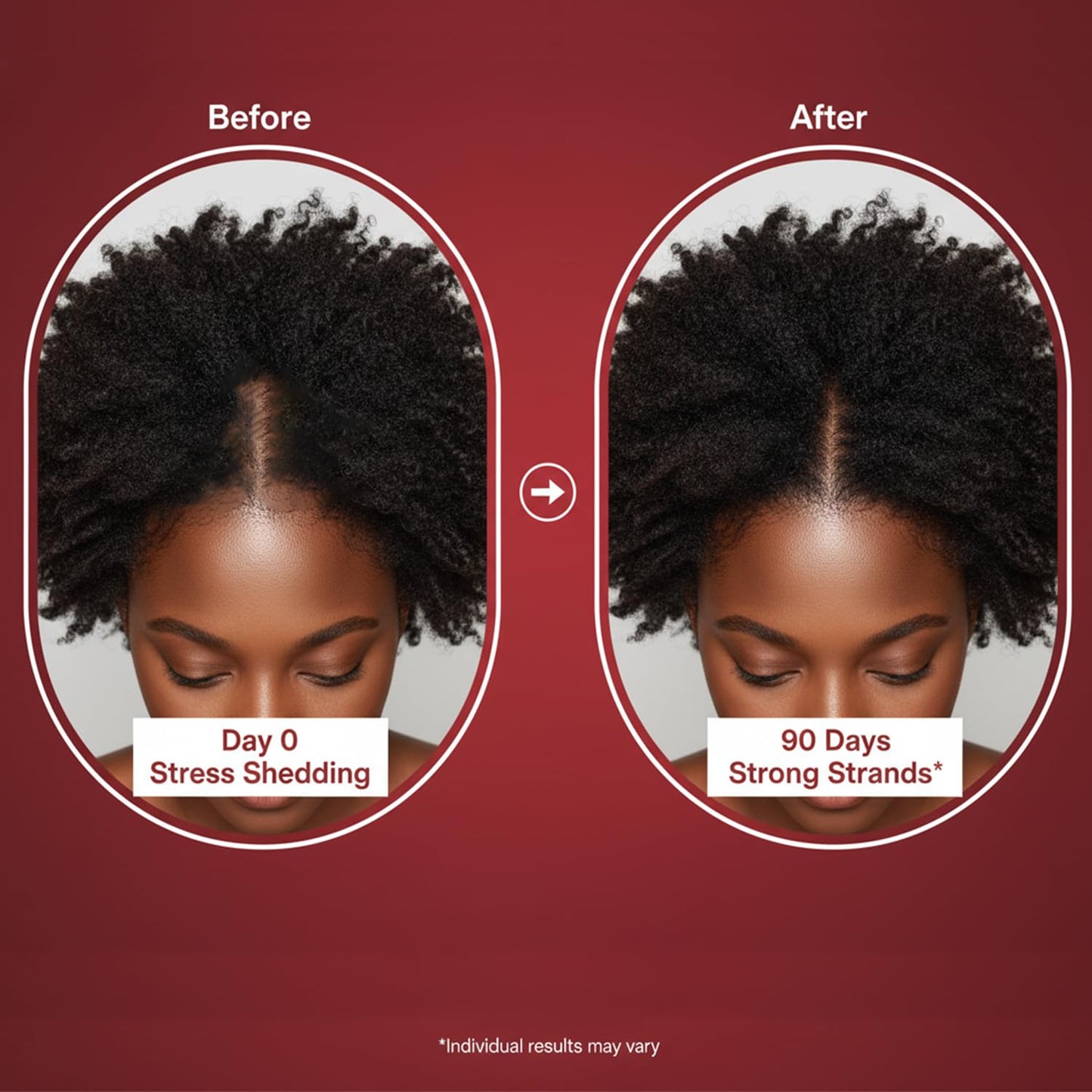 Lumin Hair Growth Gummies for Black Women, 60 Vegan Gummies, Daily Hair Nourishment with Biotin, Collagen & Botanical Extracts, Supports Healthy Hair Growth & Strength Lumin HairUS supplements