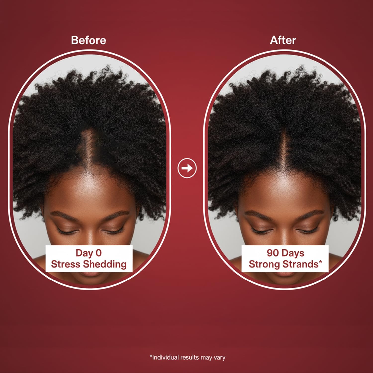 Lumin Hair Growth Gummies for Black Women, 60 Vegan Gummies, Daily Hair Nourishment with Biotin, Collagen & Botanical Extracts, Supports Healthy Hair Growth & Strength Lumin HairUS supplements
