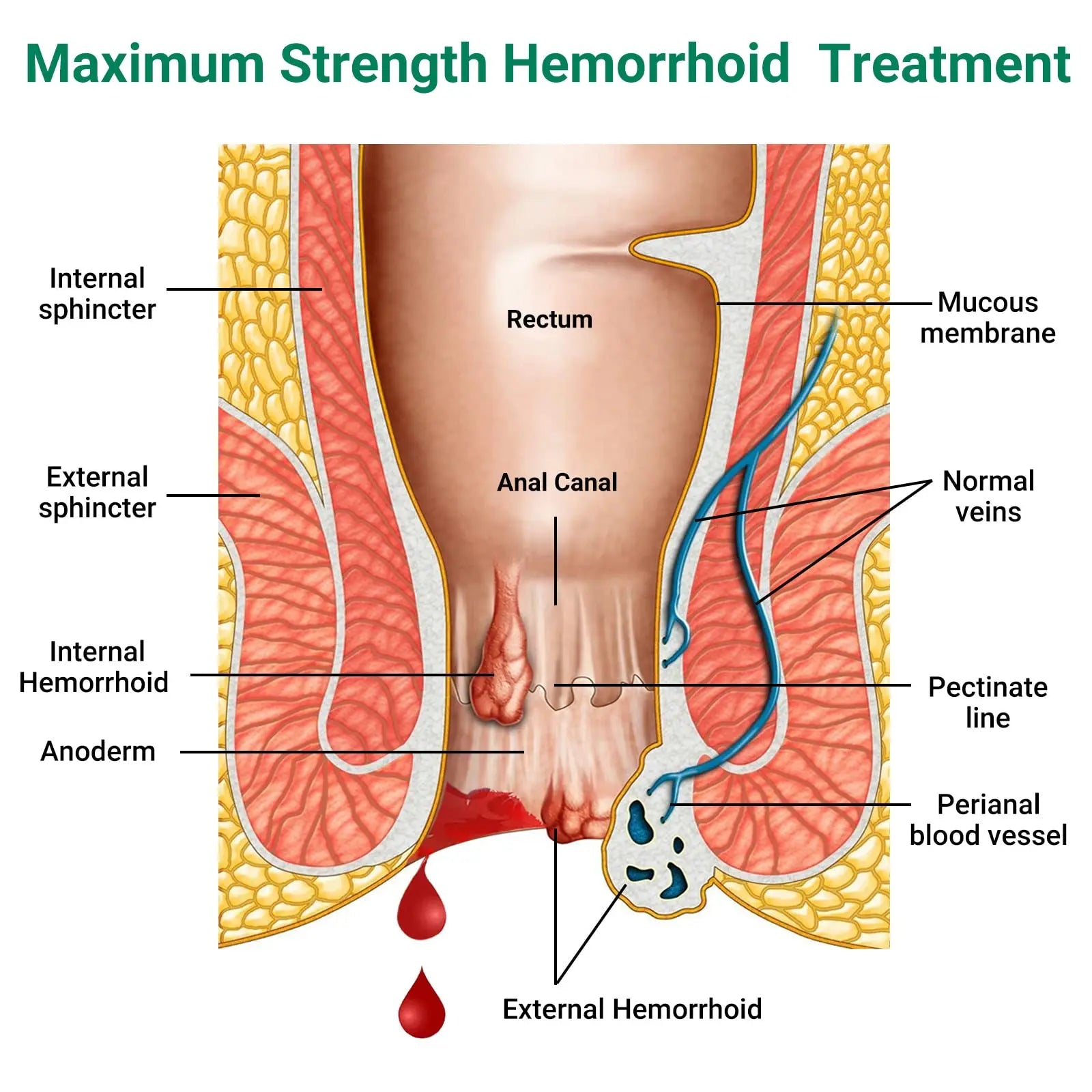 Hemorrhoid Treatment Ointment, Maximum Strength Treatment & Fast Relief for Pain, Itching, Burning, Swelling, Fissure, Bleeding, Discomfort, Long-Lasting Internal & External Hemorrhoid Cream, (2-Pack) LMNOOPAu supplements