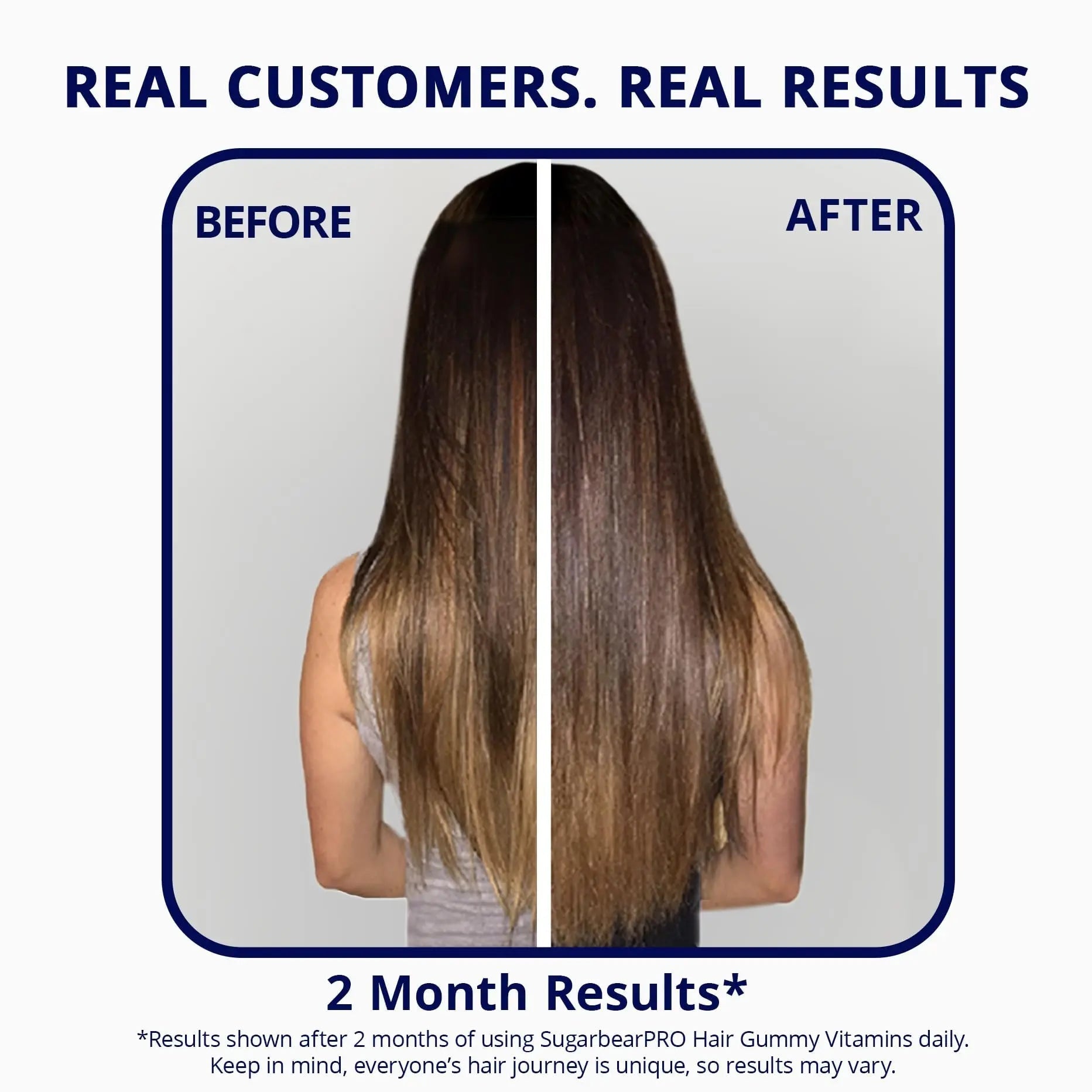 SugarBearPro Hair Vitamin Gummy 3 Month Supply Extra Strength Biotin 6000mcg, Growth for Men & Women, Vegan Vitamin B12 SugarBearHairAu supplements