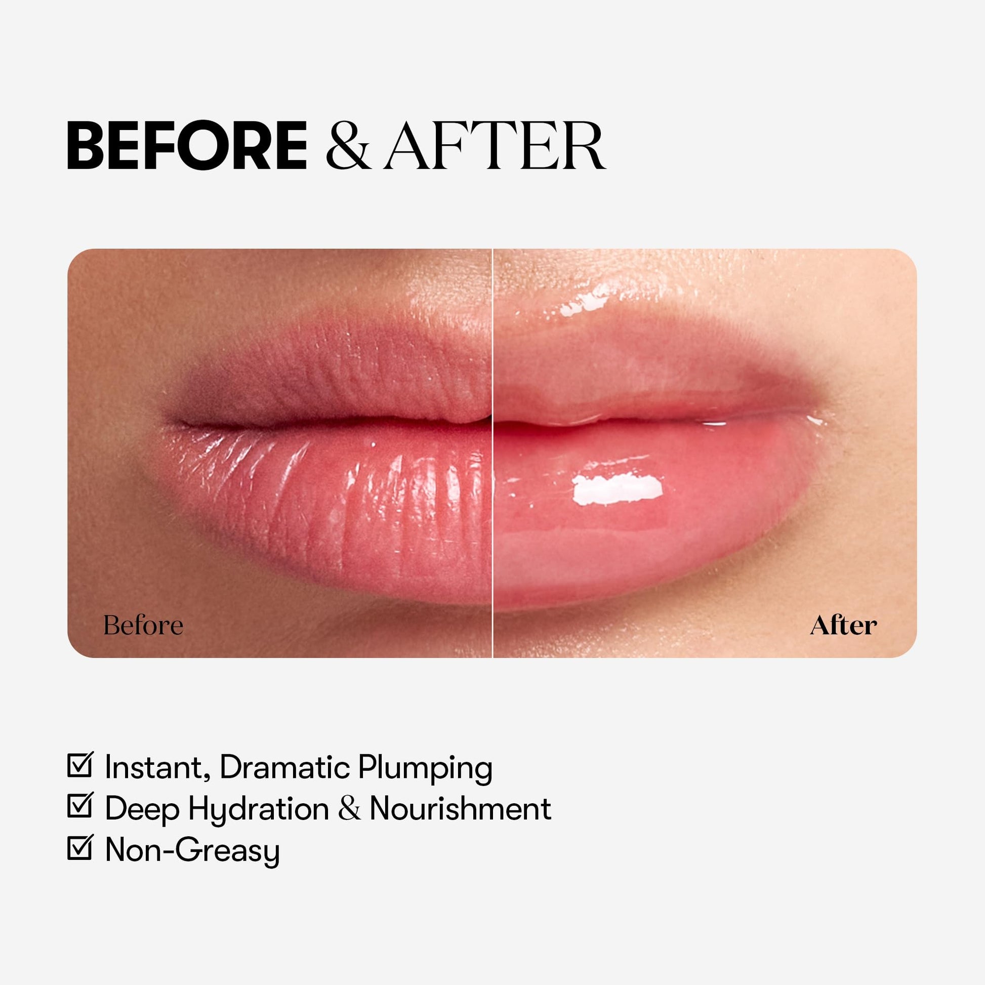 VTCOSMETICS Reedle Shot Lip Plumper, 0.15 oz (4.3 g), Moisturizing, Transparent, Lip Gloss, Fragrance-free, Korean Cosmetics (Expert) VT COSMETICSAu supplements