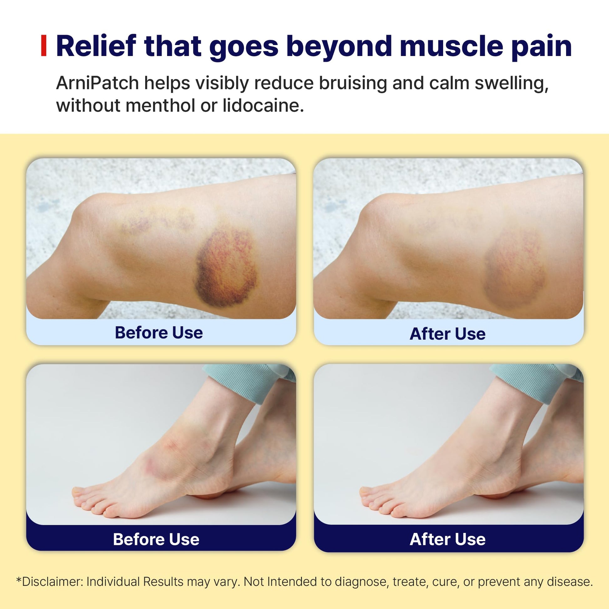 Arnica Hydrogel Pain Relief Patches | Natural Relief for Muscle, Joint, Bruises & Swelling | Flexible, Non-Greasy & Long-Lasting | Great for Back, Knee & Neck Pain (3.9"x4.7", 10, Count) Wooshin LabottachAu supplements