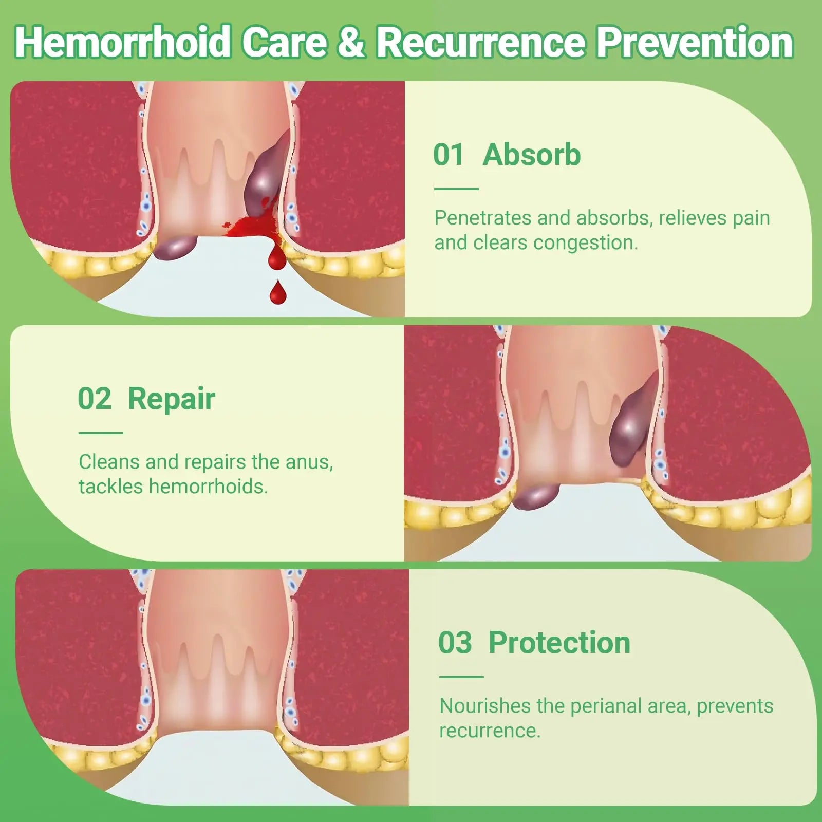 Hemorrhoid Treatment Ointment - Tubesmaximum Strength - Fast Relief from Pain, Itching, Burning, Swelling & Fissures | Natural Aloe & Vitamin E | Travel-Friendly10g x 5 Pieces Tubes - (1.76 Oz) yimimdeAu supplements