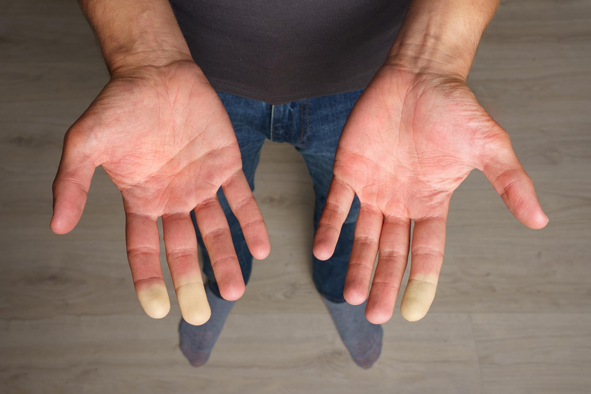 Extremity Warmth - for Cold Hands and Feet GenericAu supplements