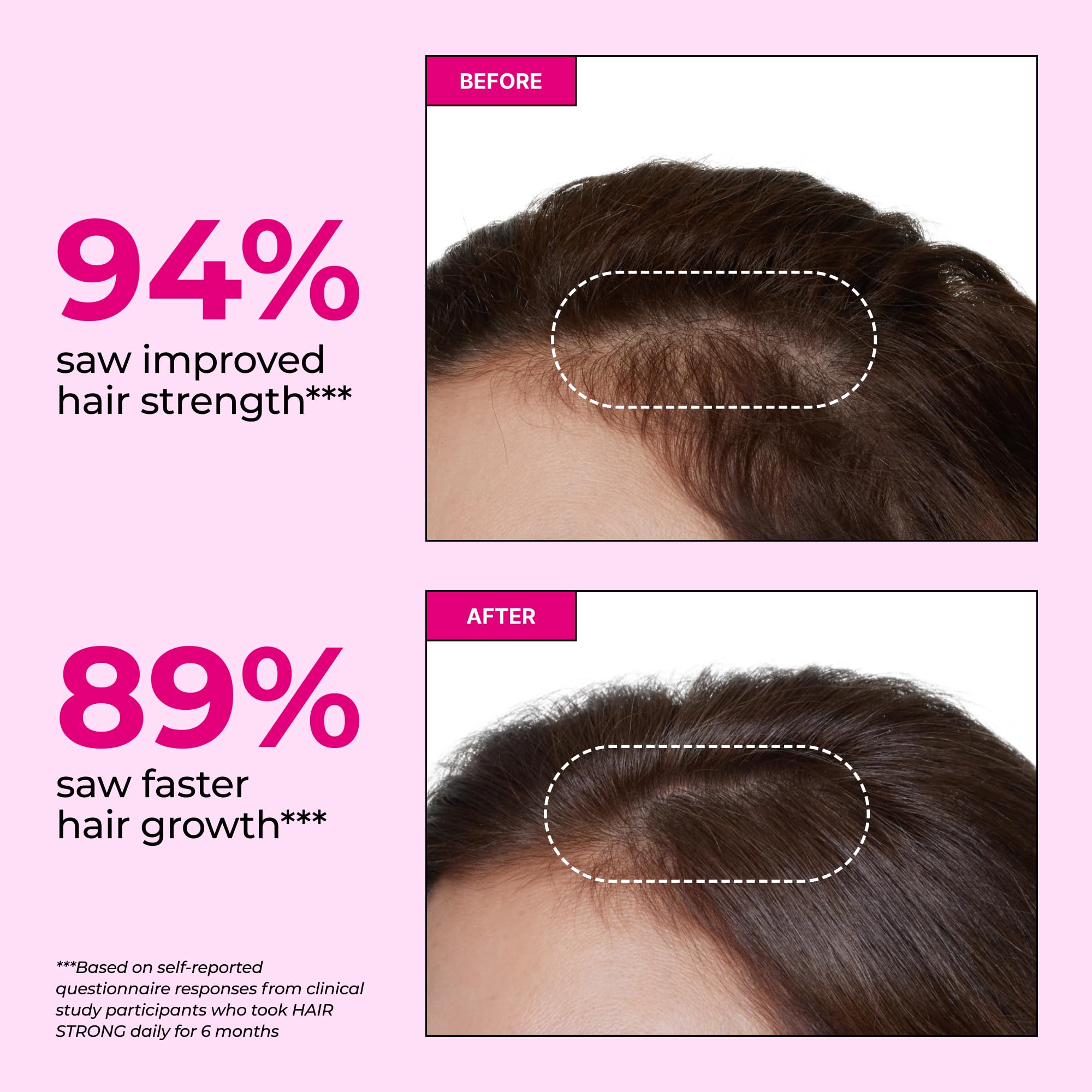 HUM Hair Strong Daily Hair Growth Gummies with Biotin, Zinc, Vitamin B12 to Support Growth, Folic Acid & Vitamin B12 Gummy Vitamins for Healthy Hair Support for Women and Men, 60 Gummies HUMAu supplements