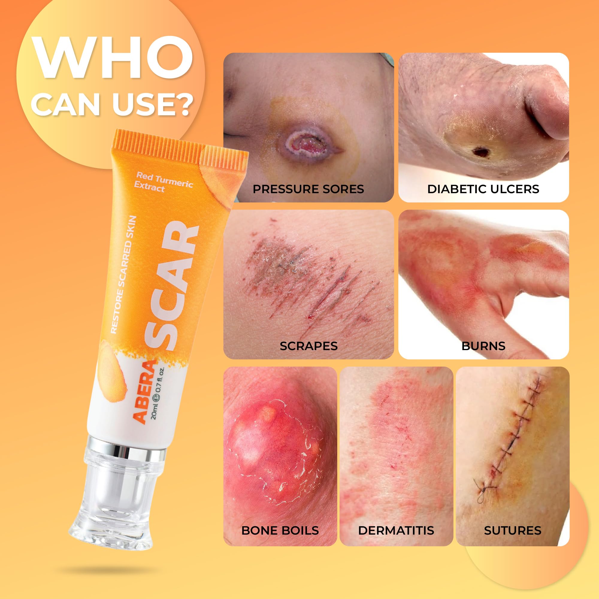 ABERA Scar Removal Cream for Women and Men - Rapid Repair of New Old Scars, Spots, Burns All Natural Treatment with Vitamin E, Alanine, Collagen (1 Box + 3 Eye Patch) ABERAAu supplements