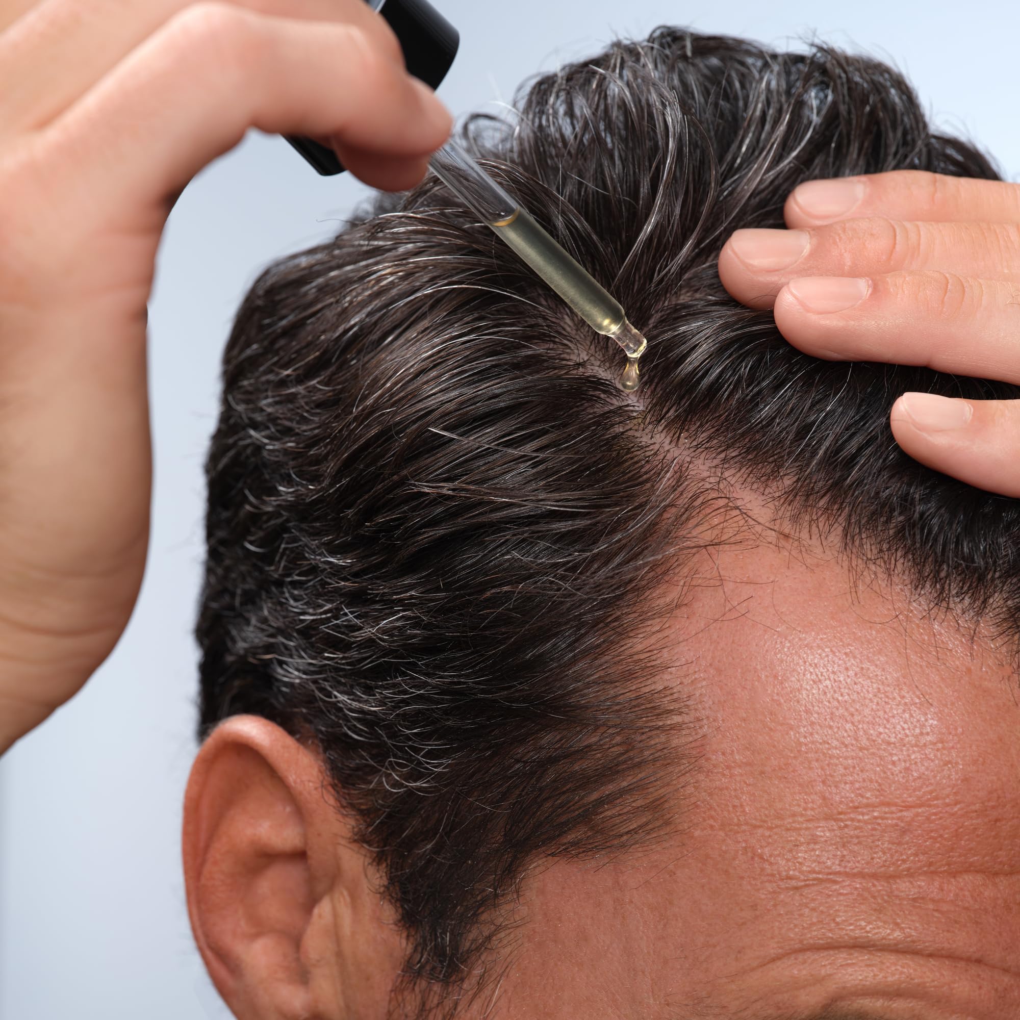 Caldera + Lab The Hair Serum | Men’s Thickening Serum for Thinning & Receding Hair, Supports Fuller & Stronger-Looking Hair, Dermatologically Tested - All Hair Types Caldera + LabAu supplements