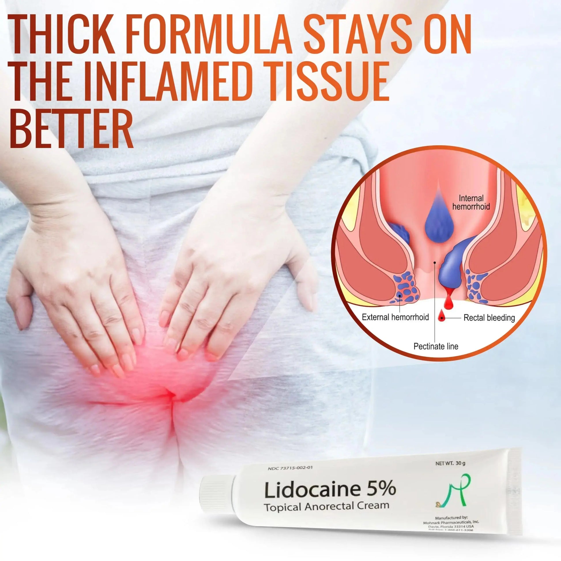 Mohnark Maximum Strength Lidocaine Hemorrhoid Treatment Cream for External and Internal Hemorrhoids Treatment Burn Itch Pain Relief Anal Cream Topical Anorectal Numbing Cream- 30 Gram Tube Made in USA MOHNARKAu supplements