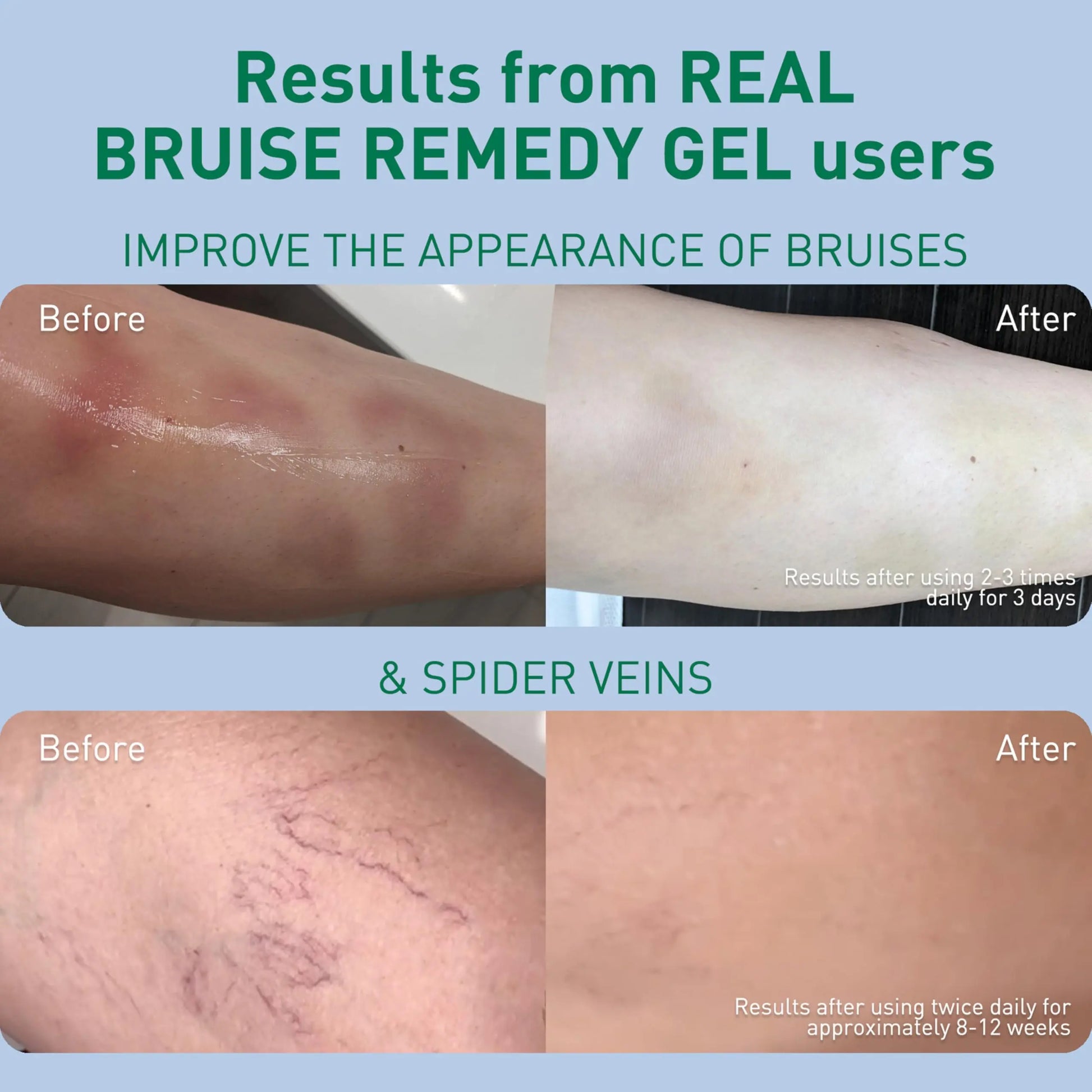 PROcure Arnica & MSM Bruise Remedy Gel – Paraben-Free, Unscented Arnica Montana Gel for Bruising, Spider Veins & Skin Discoloration – 2 Pack PROcureAu supplements