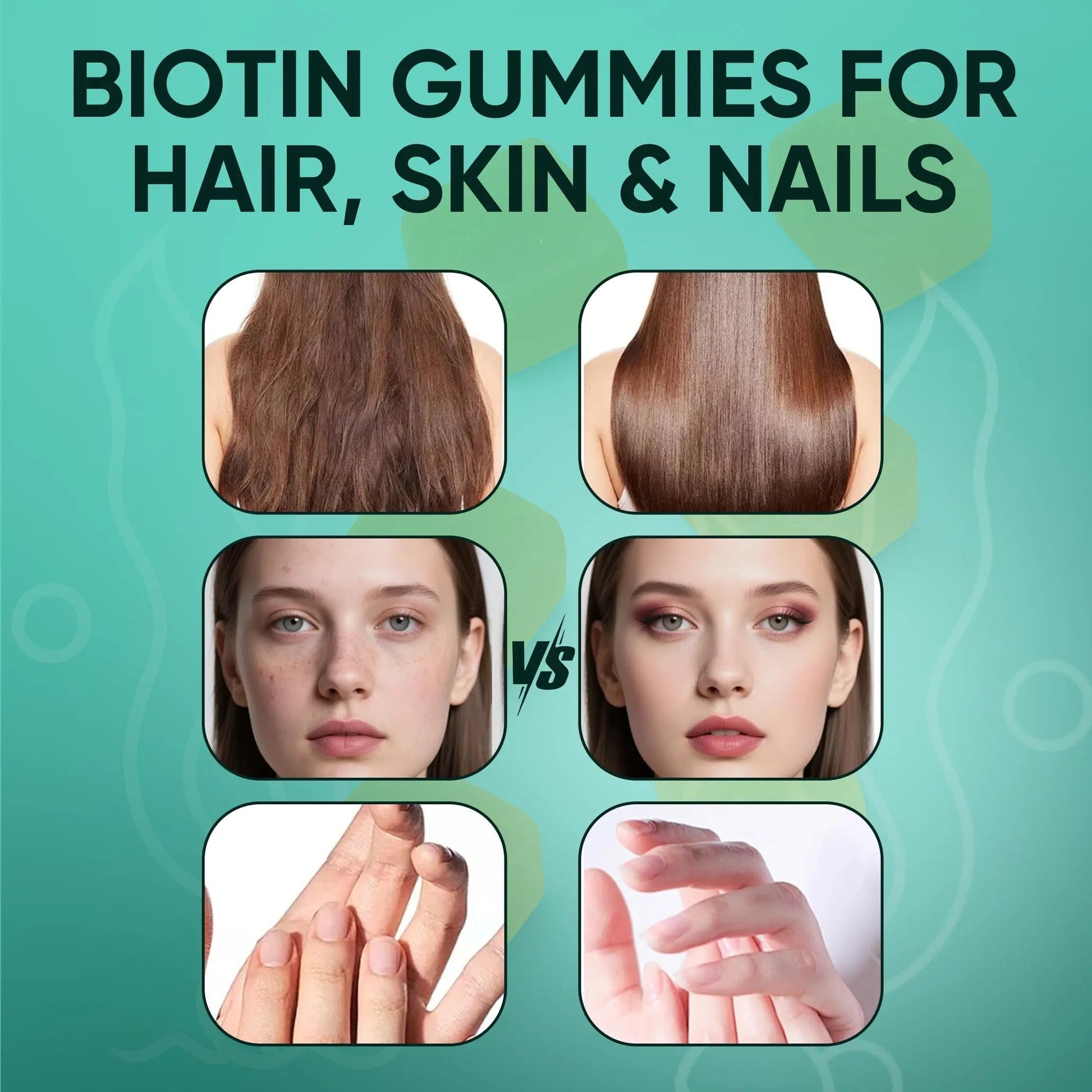Neonomicon Balmbare Revive Gummies for Hair Loss - Sea Moss Gummies with Vitamin C, Vitamin E, Aloe Vera, Pearl Powder Supports Faster Hair Growth NeonomiconAu supplements