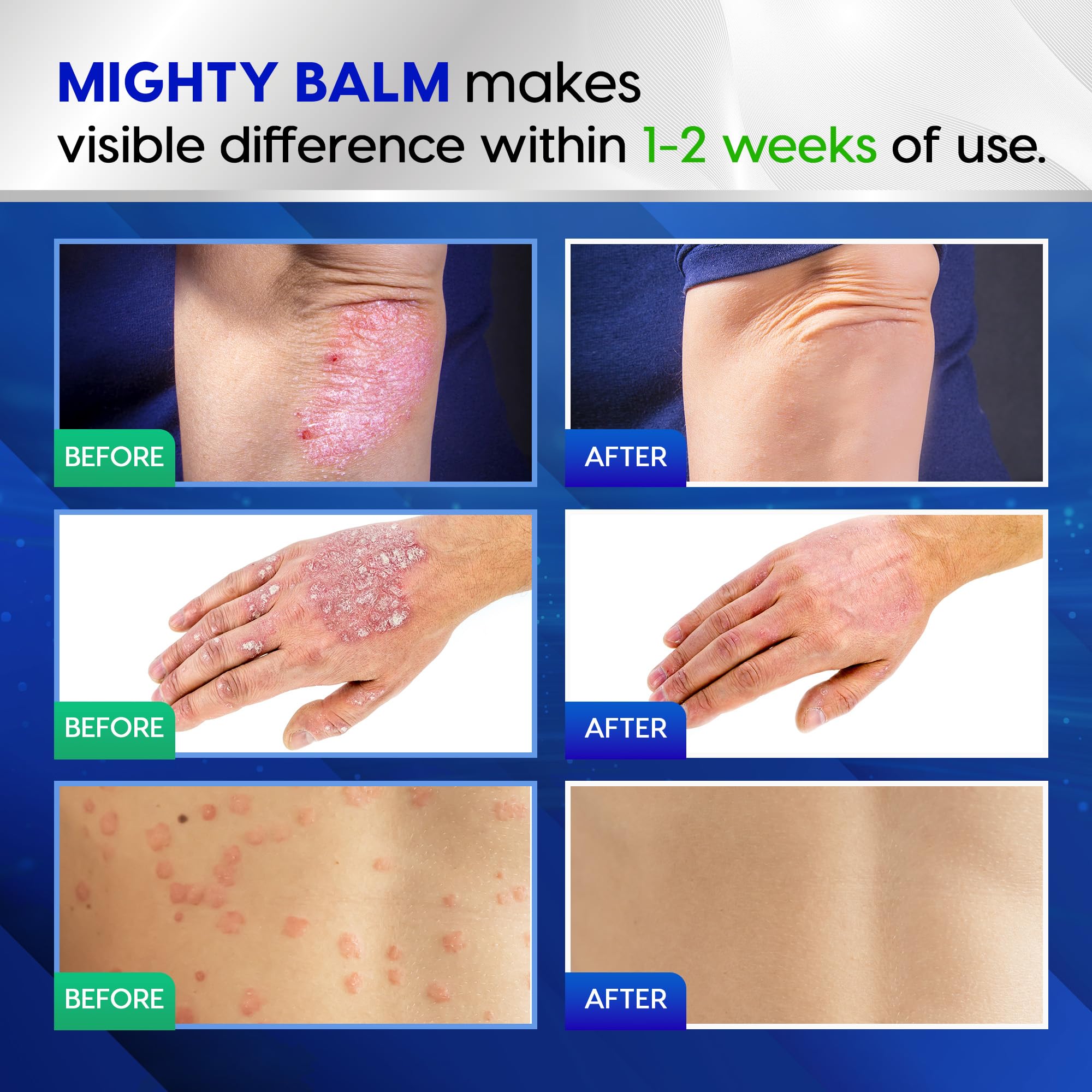 Tobcharm Antifungal Cream, Antifungal Cream for Skin, Ringworm Treatment for Humans TobcharmUS supplements