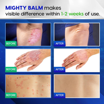 Tobcharm Antifungal Cream, Antifungal Cream for Skin, Ringworm Treatment for Humans TobcharmUS supplements