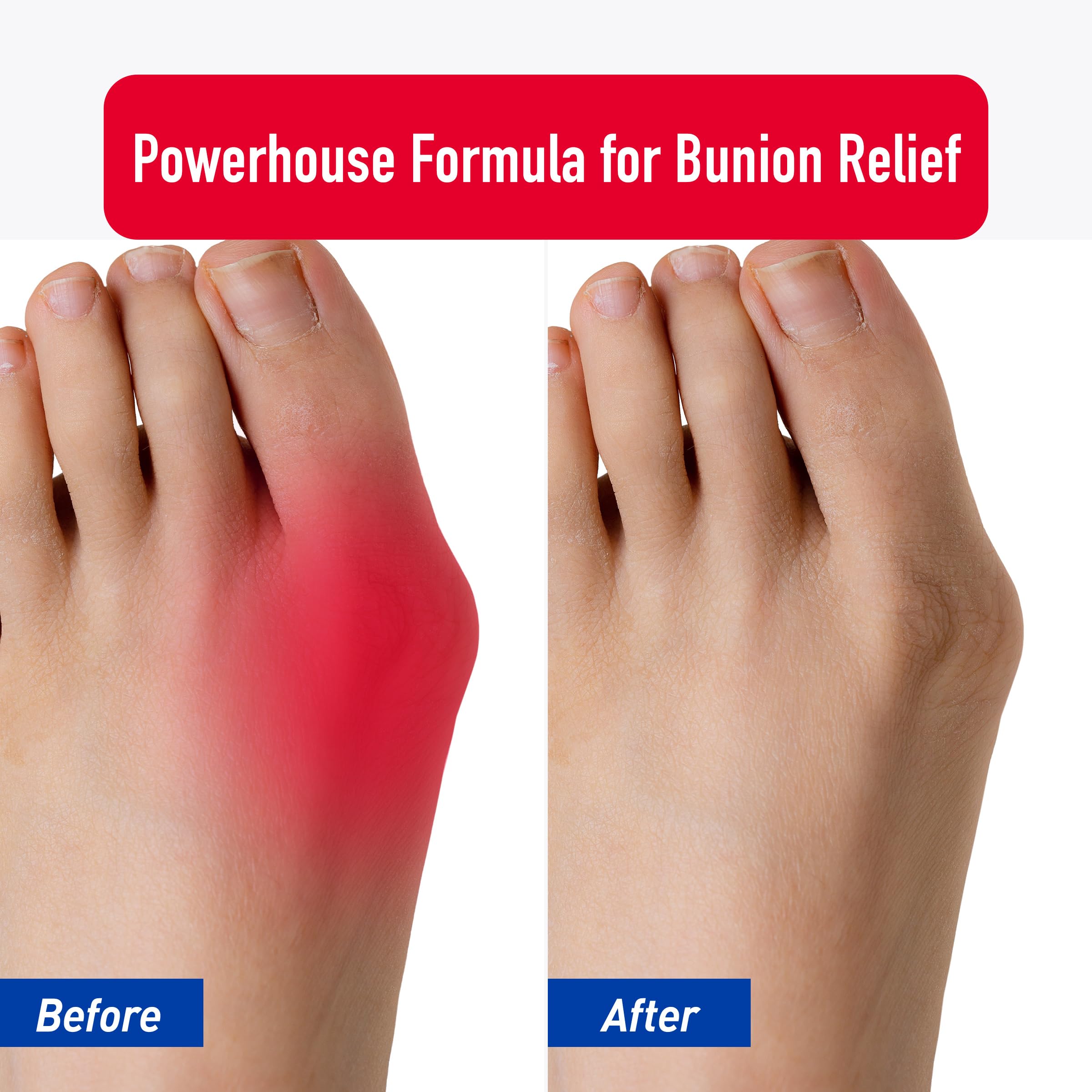 PROFOOT Bunion Relief Rub, White Heal&RescueAu supplements