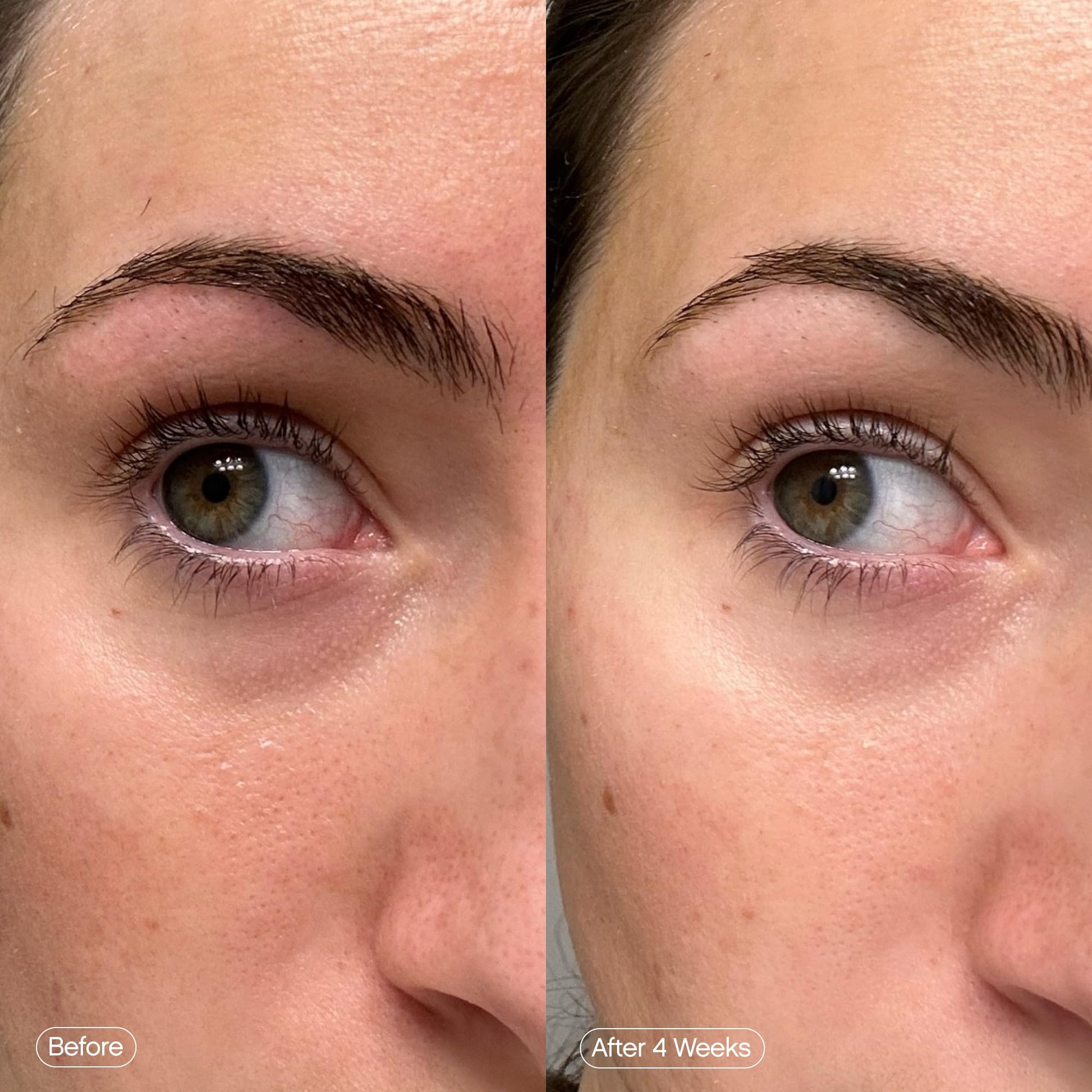 Topicals Faded Brightening Under Eye Masks | Patches to Depuff, Hydrate, Brighten and Cool | Reduce Dark Circles and Fine Lines | Contains Kojic Acid, Caffeine and Niacinamide (Set of 6) TopicalsAu supplements
