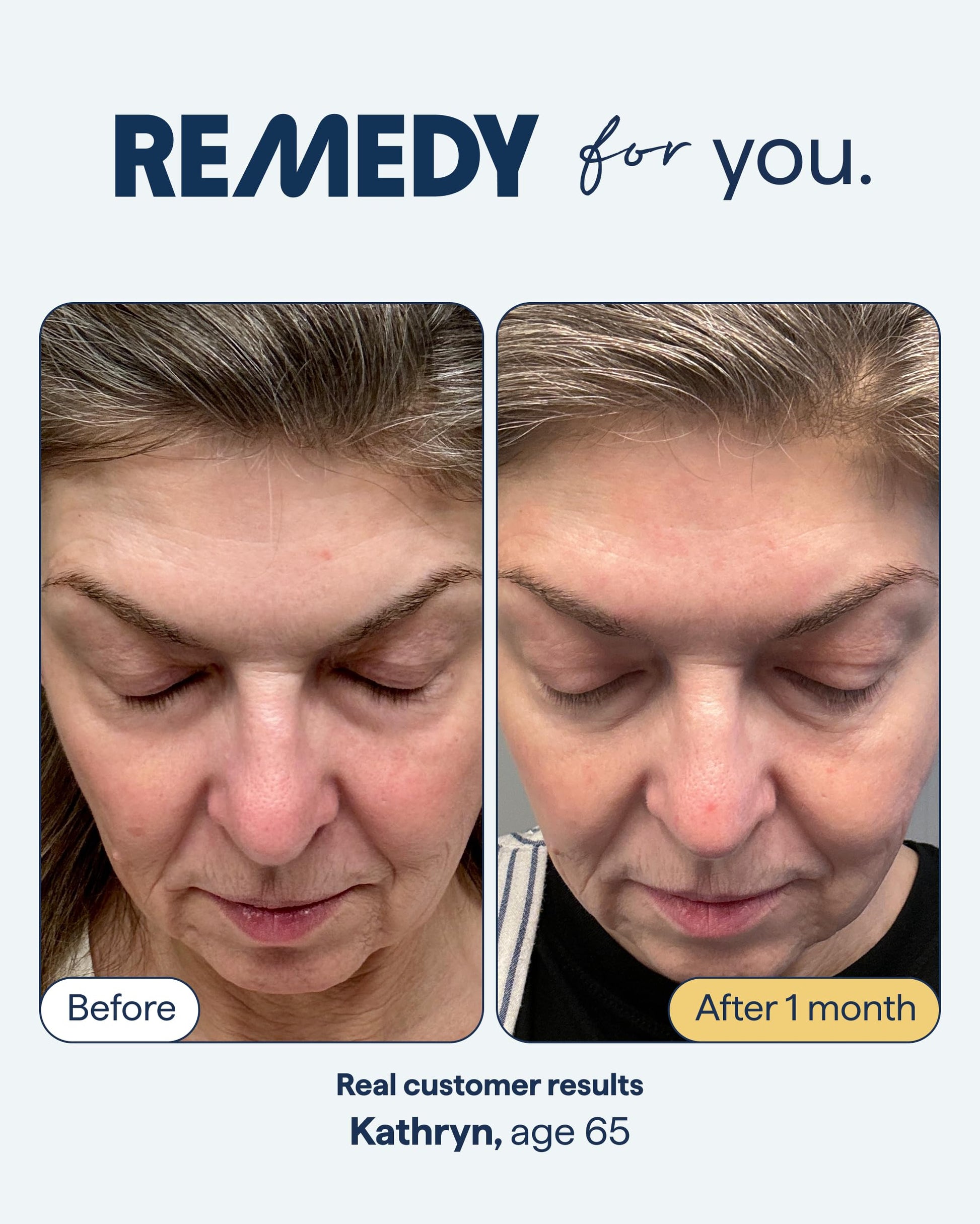 Remedy for Healthy Aging - Retinal, Resveratrol, Glycolic Acid, Argireline, Ferulic Acid, Matrixyl 3000 - Anti-Aging Treatment for Wrinkles, Uneven Texture & Tone - By Dermatologist Dr. Shah Remedy ScienceAu supplements