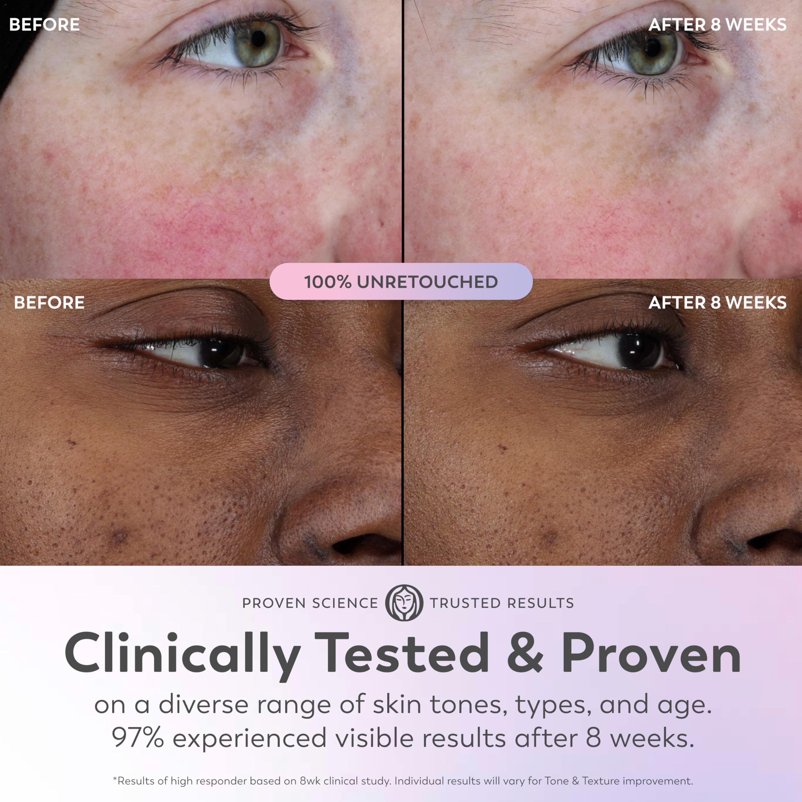 Olay Super Serum - Glow Serum for Face - Activated Niacinamide, Vitamin C & E, Collagen Peptide, AHA - 5-in-1 Benefits - Brightens, Hydrates, Smooths, Firms, Evens Tone, Proactive Anti-Aging, 1.7 Oz OlayAu supplements
