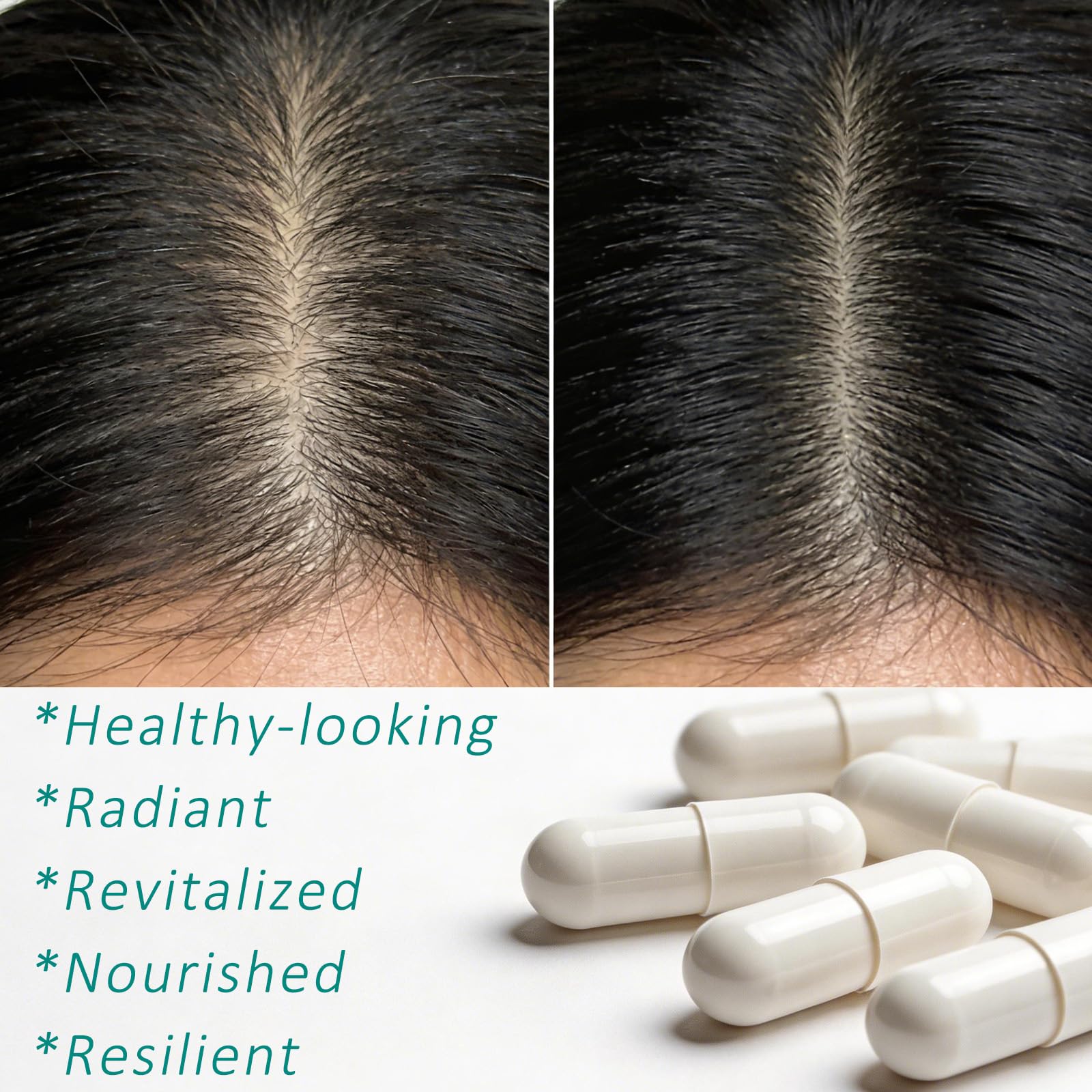 Hair Growth Biotin 10000mcg Supplement with Vitamins A C D E & Calcium - 30-in-1 Formula for Hair & Nails Support, for Women & Men, 30 Servings (1) WOJJAu supplements
