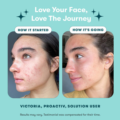 Proactiv 3 Step Acne Treatment - Benzoyl Peroxide Face Wash, Repairing Acne Spot Treatment for Face and Body ProactivUS supplements
