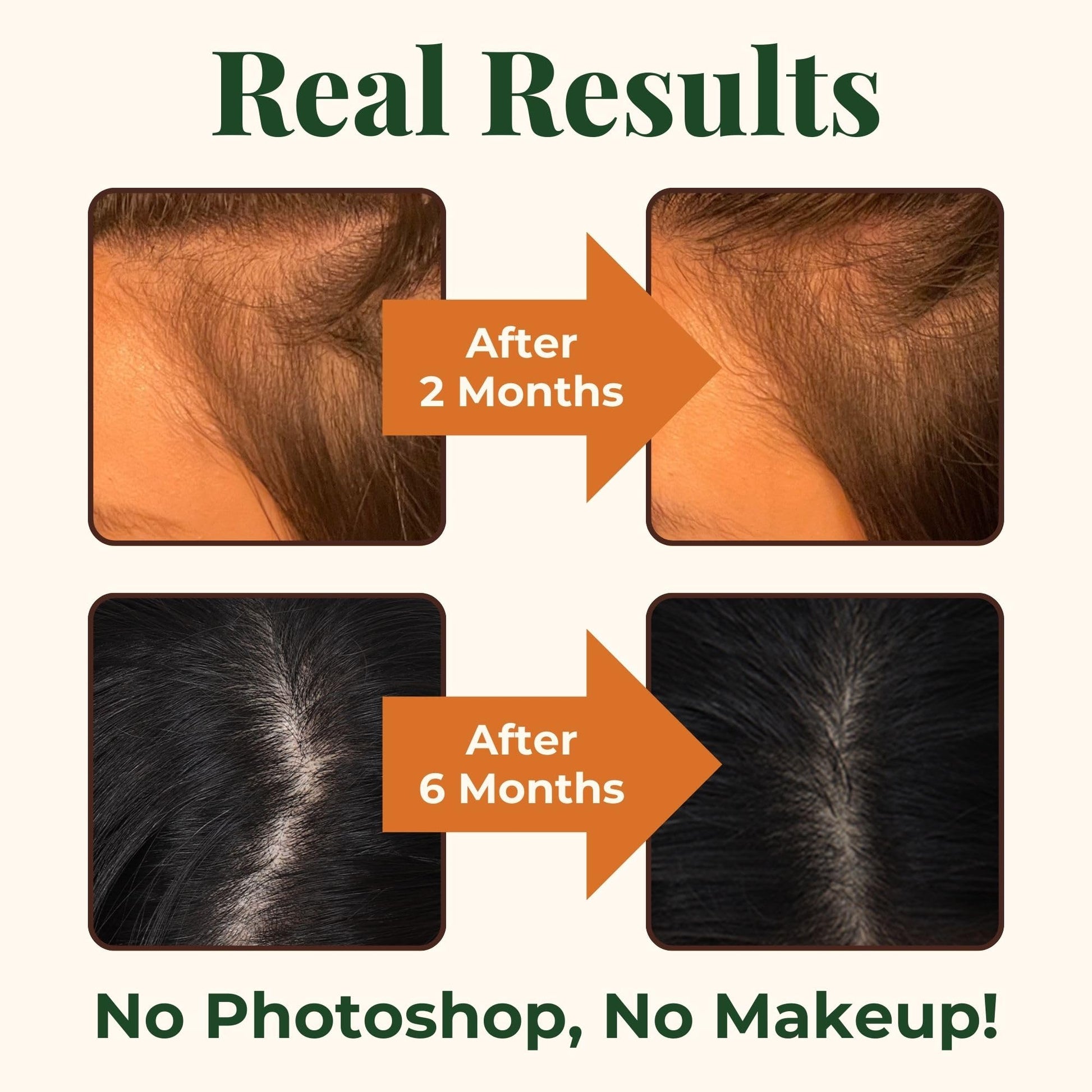 Heebin's Royal Hair, Brows & Lashes, Hair Growth Vitamins with Biotin 4000 mcg, Collagen Heebin'sAu supplements