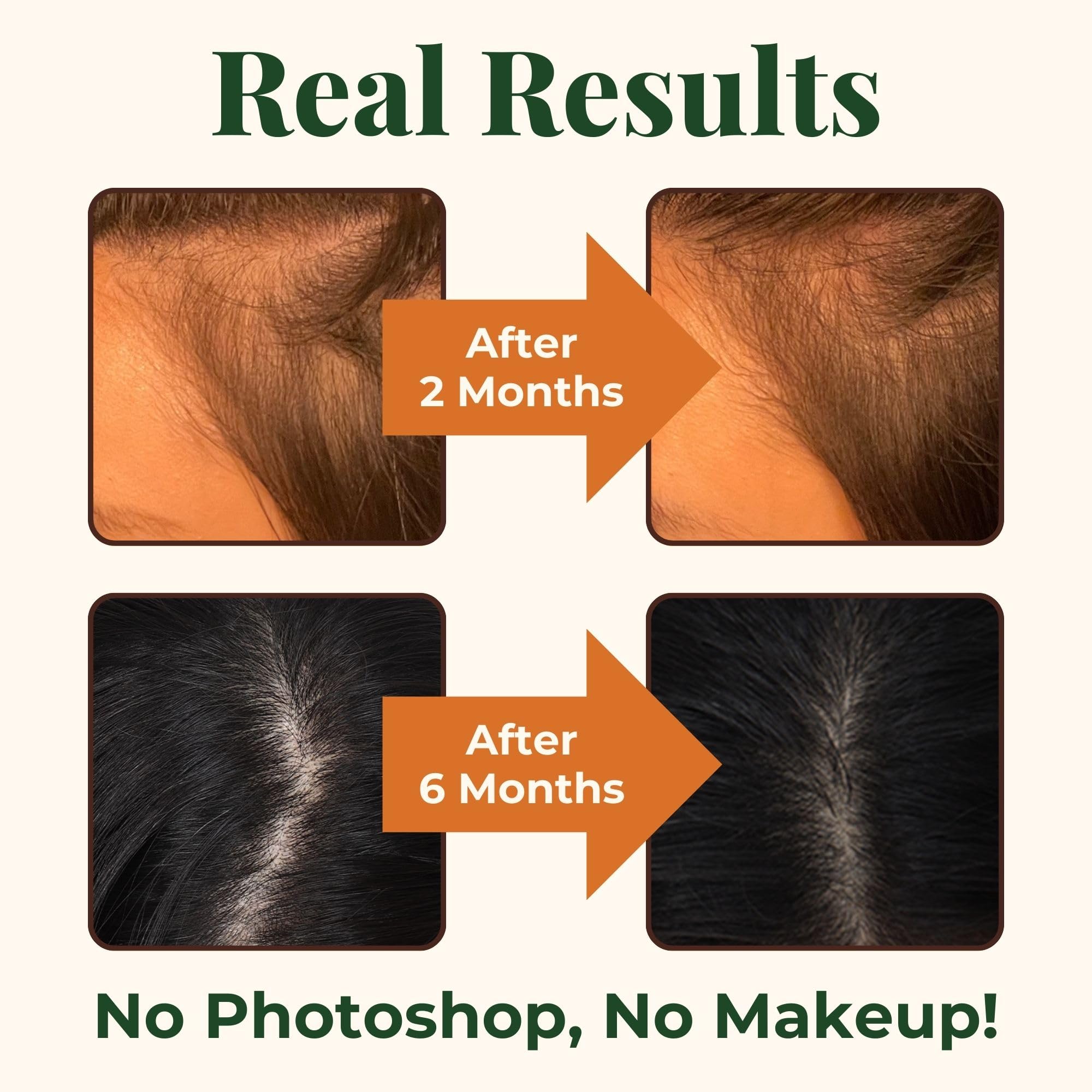 Heebin's Royal Hair, Brows & Lashes, Hair Growth Vitamins with Biotin 4000 mcg, Collagen Heebin'sAu supplements