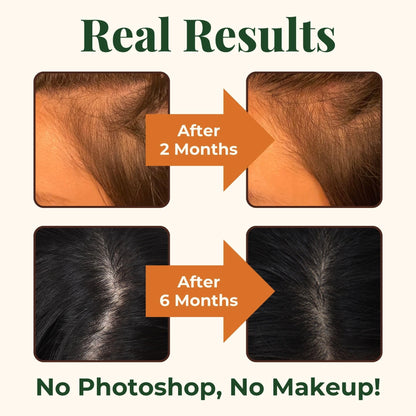 Heebin's Royal Hair, Brows & Lashes, Hair Growth Vitamins with Biotin 4000 mcg, Collagen Heebin'sUS supplements
