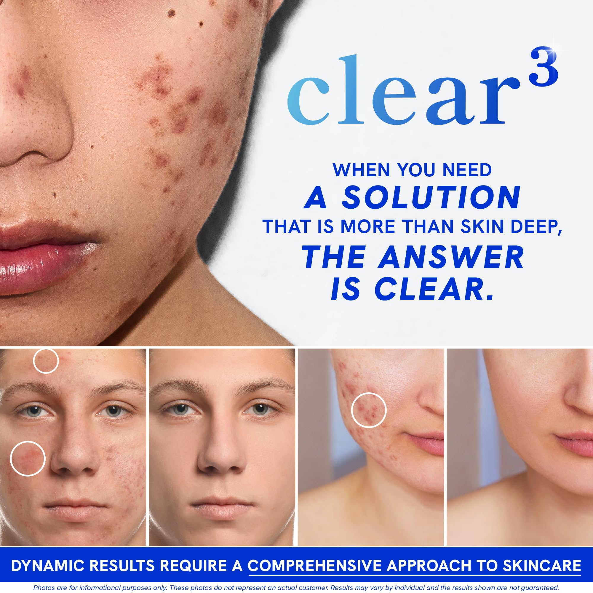 Clear Skin Supplement with Zinc, DIM & Probiotics | 3-in-1 Balance, Glow & Health Skin Support | Triple Action Hyaluronic Acid, Niaciminide & Vitamins for Hormone, Complexion & Gut Support | 180 Ct SMNutritionAu supplements