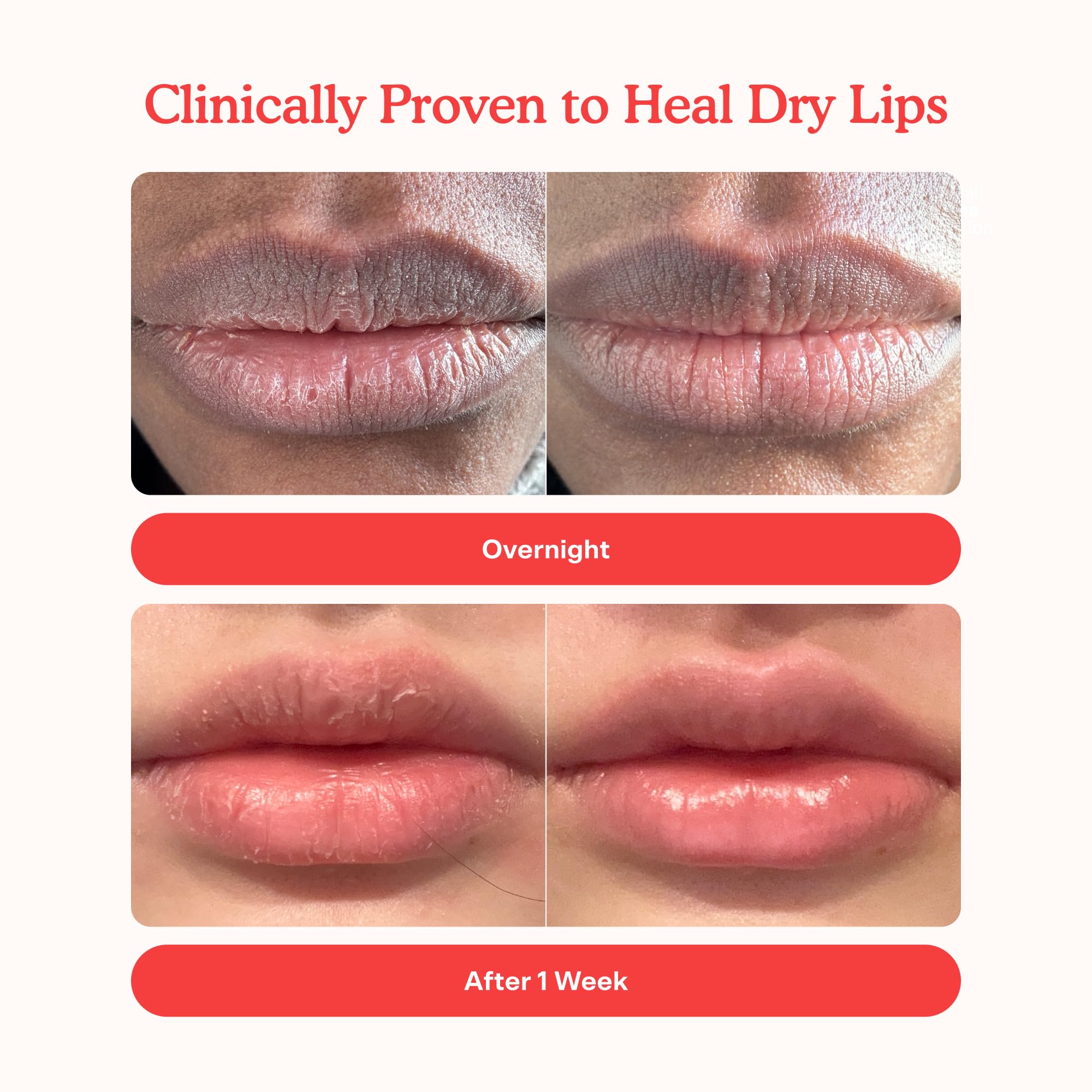 Tower 28 LipSoftie Tinted Lip Balm Treatment - Hydrating Glossy Balm + Overnight Lip Mask with Jojoba Oil + Shea Butter - Sweet