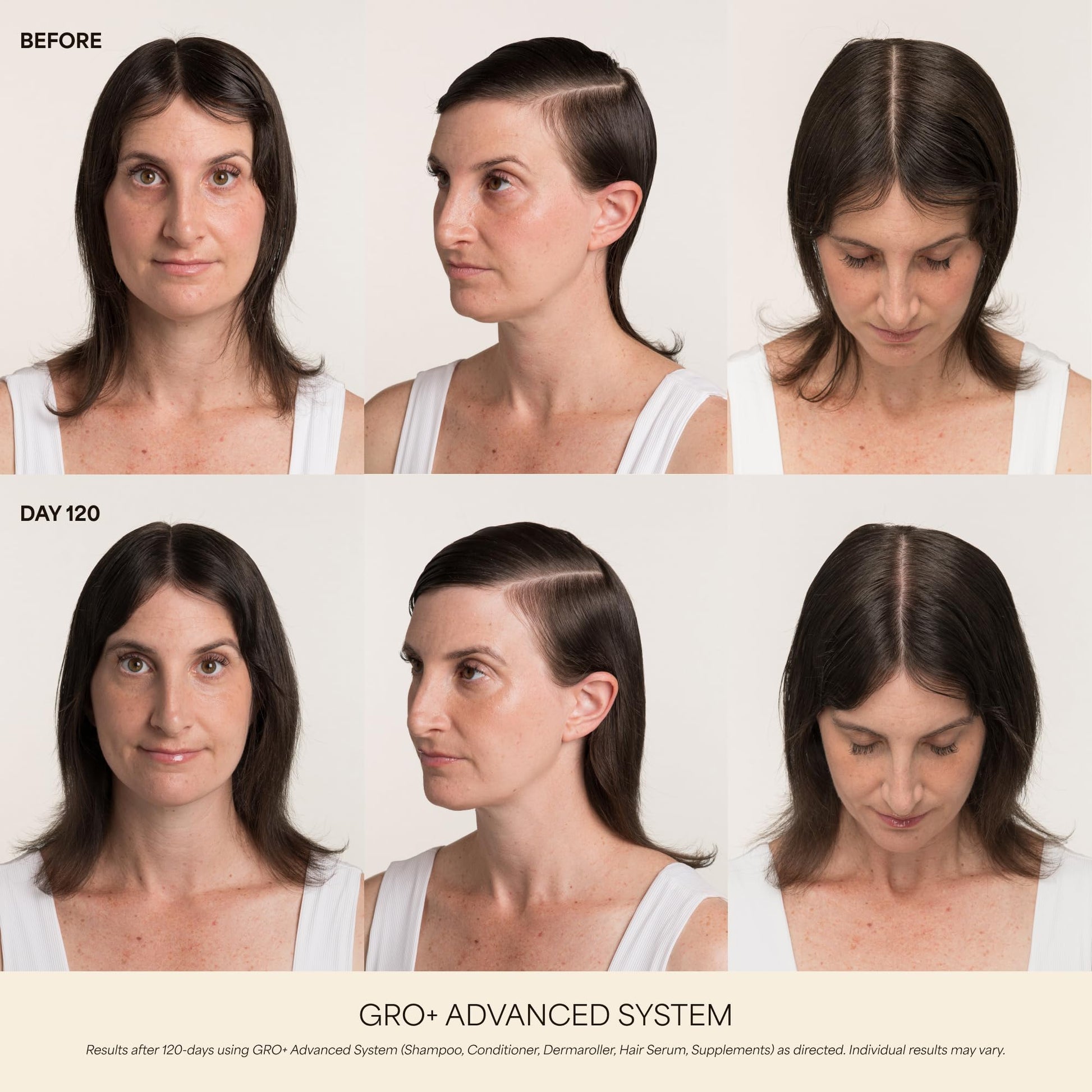 VEGAMOUR GRO+ Advanced Hair Growth Vitamin Supplements - Boosts Hair Growth & Density - 30 Pill Packs/Box VEGAMOURAu supplements