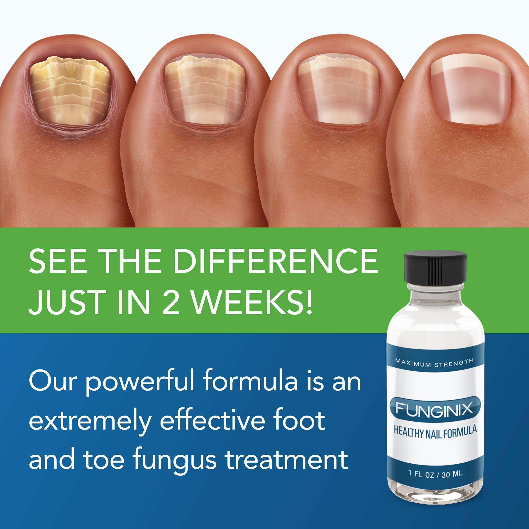 FUNGINIX Healthy Nail Formula - Finger And Toe Fungus Treatment, Made In USA, Foot FUNGINIXUS supplements