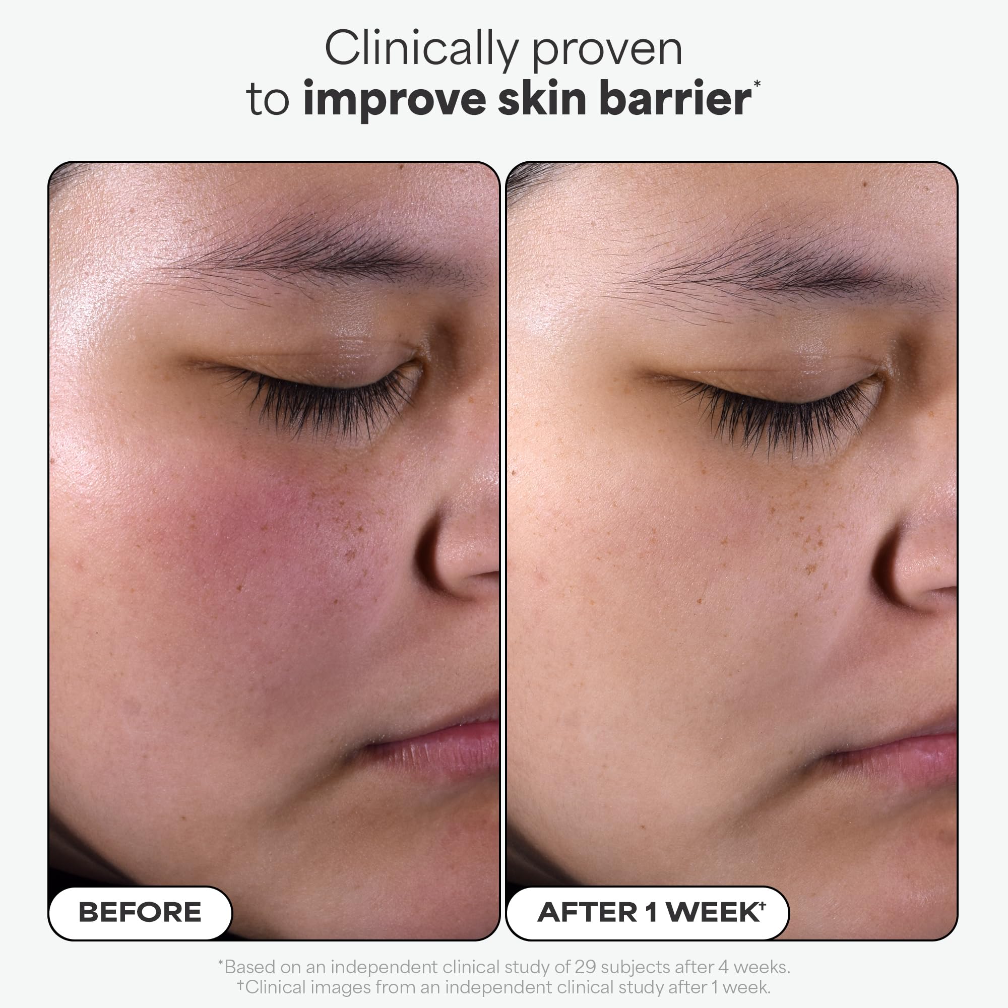 Paulas Choice--SKIN PERFECTING 2% BHA Liquid Salicylic Acid Exfoliant--Facial Exfoliant for Blackheads, Enlarged Pores, Wrinkles & Fine Lines, 4 oz Bottle Paula's ChoiceAu supplements
