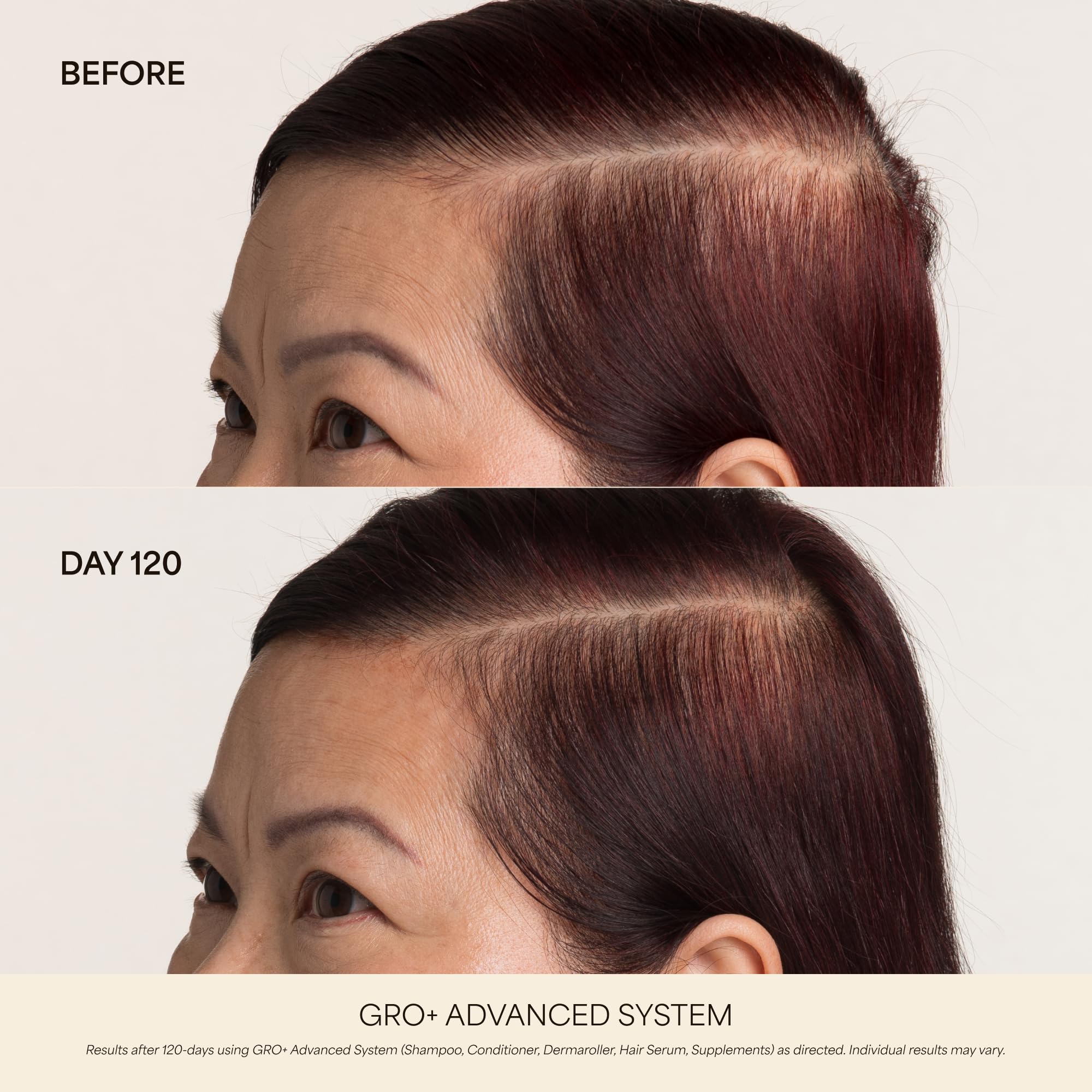 VEGAMOUR GRO+ Advanced Hair Growth Vitamin Supplements - Boosts Hair Growth & Density - 30 Pill Packs/Box VEGAMOURAu supplements