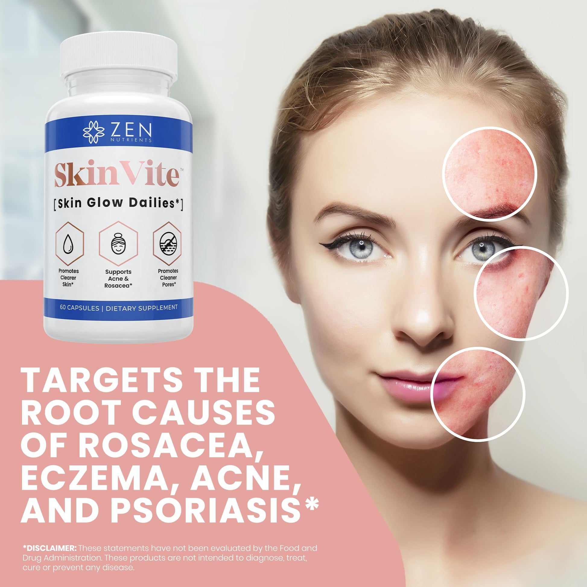 Zen Nutrients SkinVite Natural Skin Supplement for Women, Men & Teens - Hormonal Breakouts & Clear Skin Support Supplement - Detoxifying Vitamin for Acne and Digestion Support Zen NutrientsAu supplements